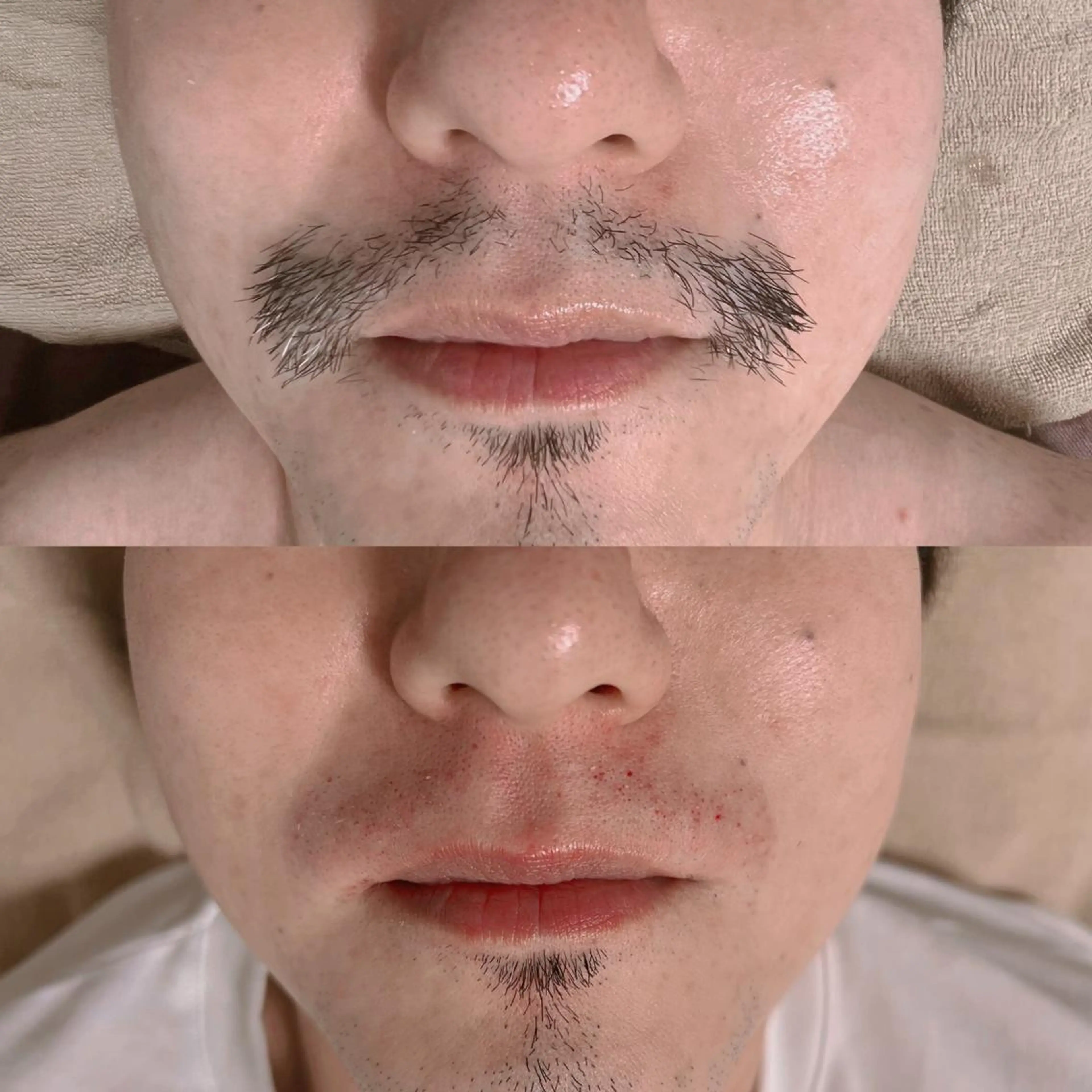 メンズ 脱毛 Epina 千葉店 【エピナ】のエステ・リラクイメージ