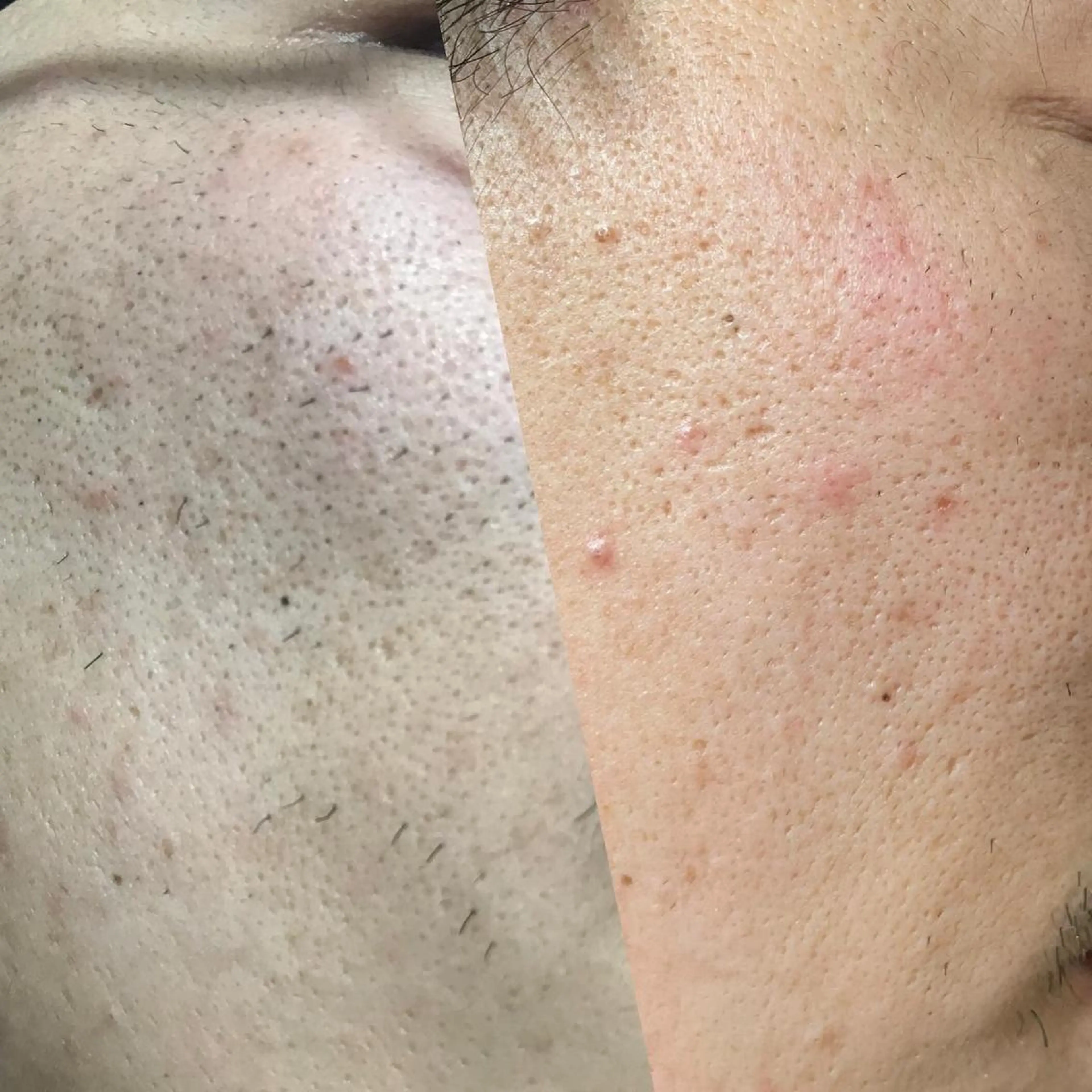 メンズ 脱毛 脱毛サロン Plageプラージュのエステ・リラクイメージ