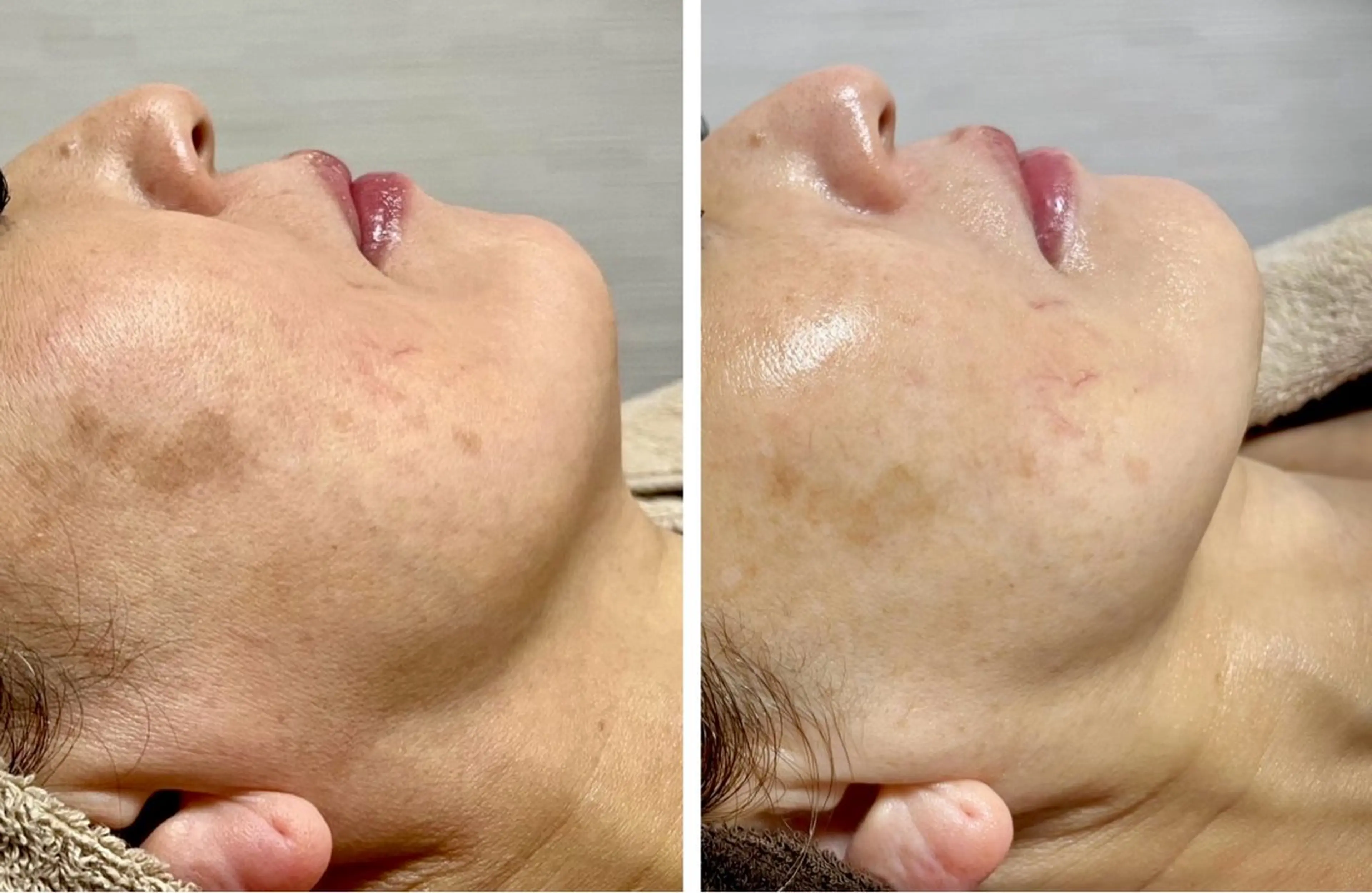 B.glossy所属・ビューティーサロン B.glossyのネイルデザイン