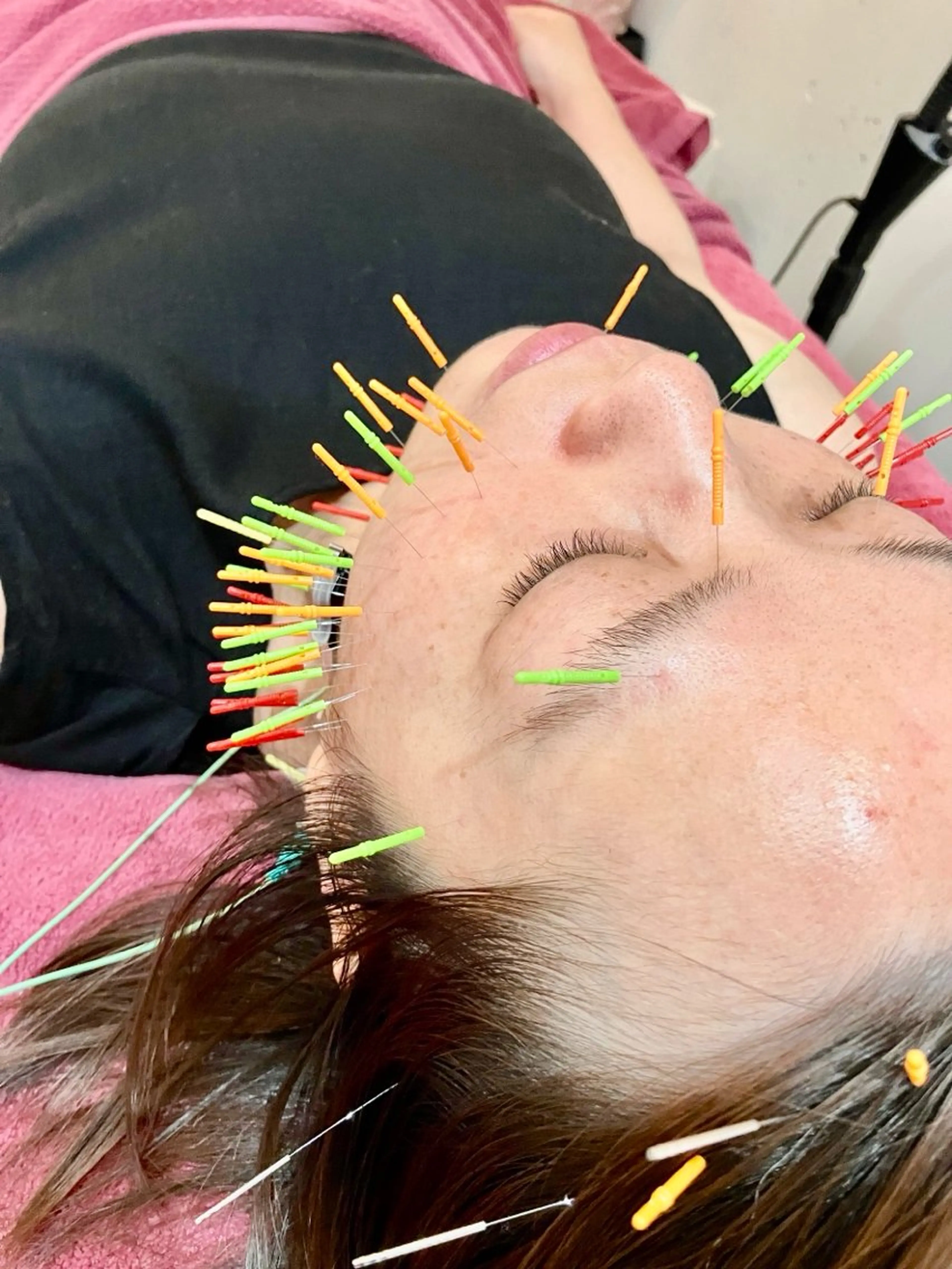 エステ リラク 美容鍼灸女性専用 りんご鍼灸治療院のその他イメージ