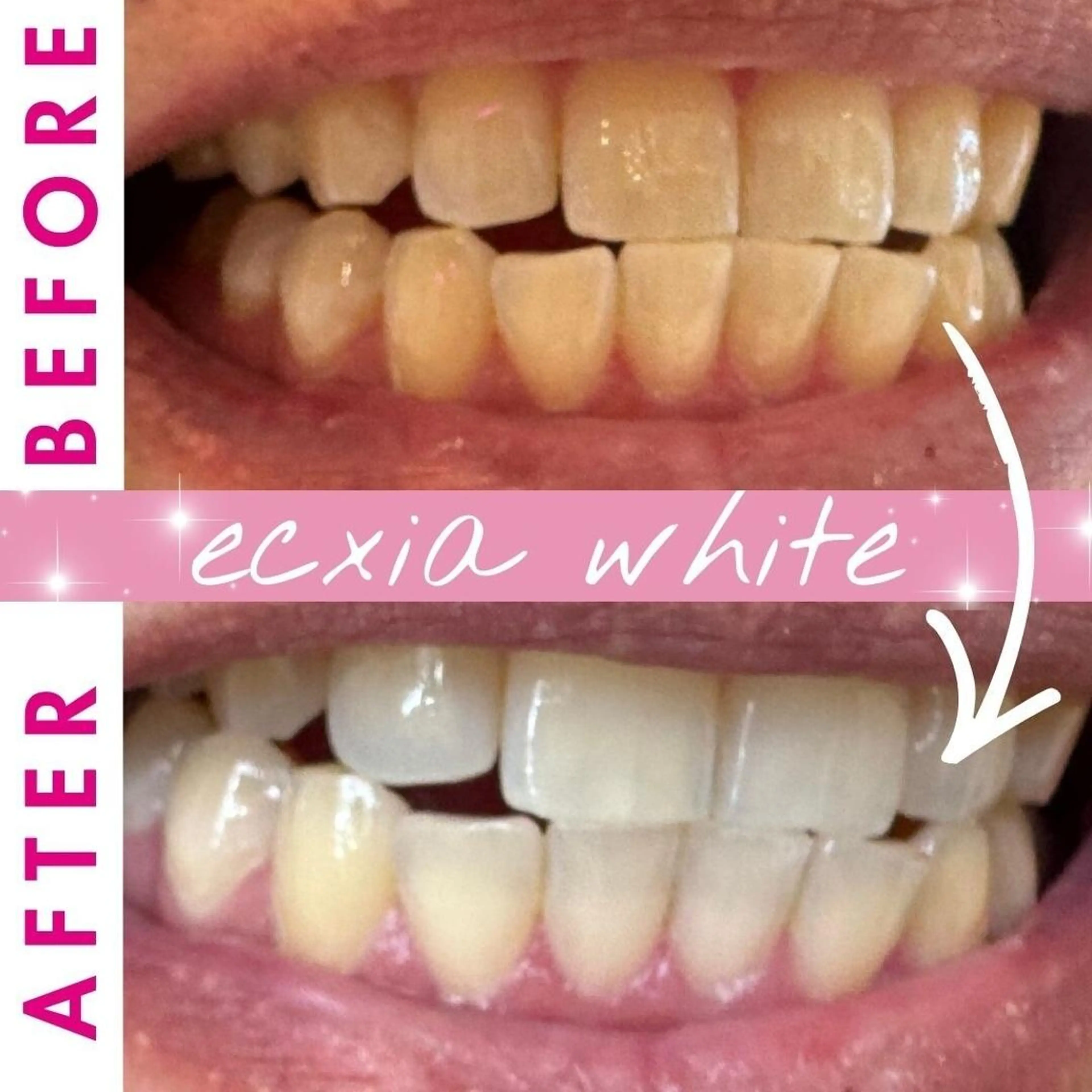 その他 セルフホワイトニング エクシア札幌大通り店のその他イメージ