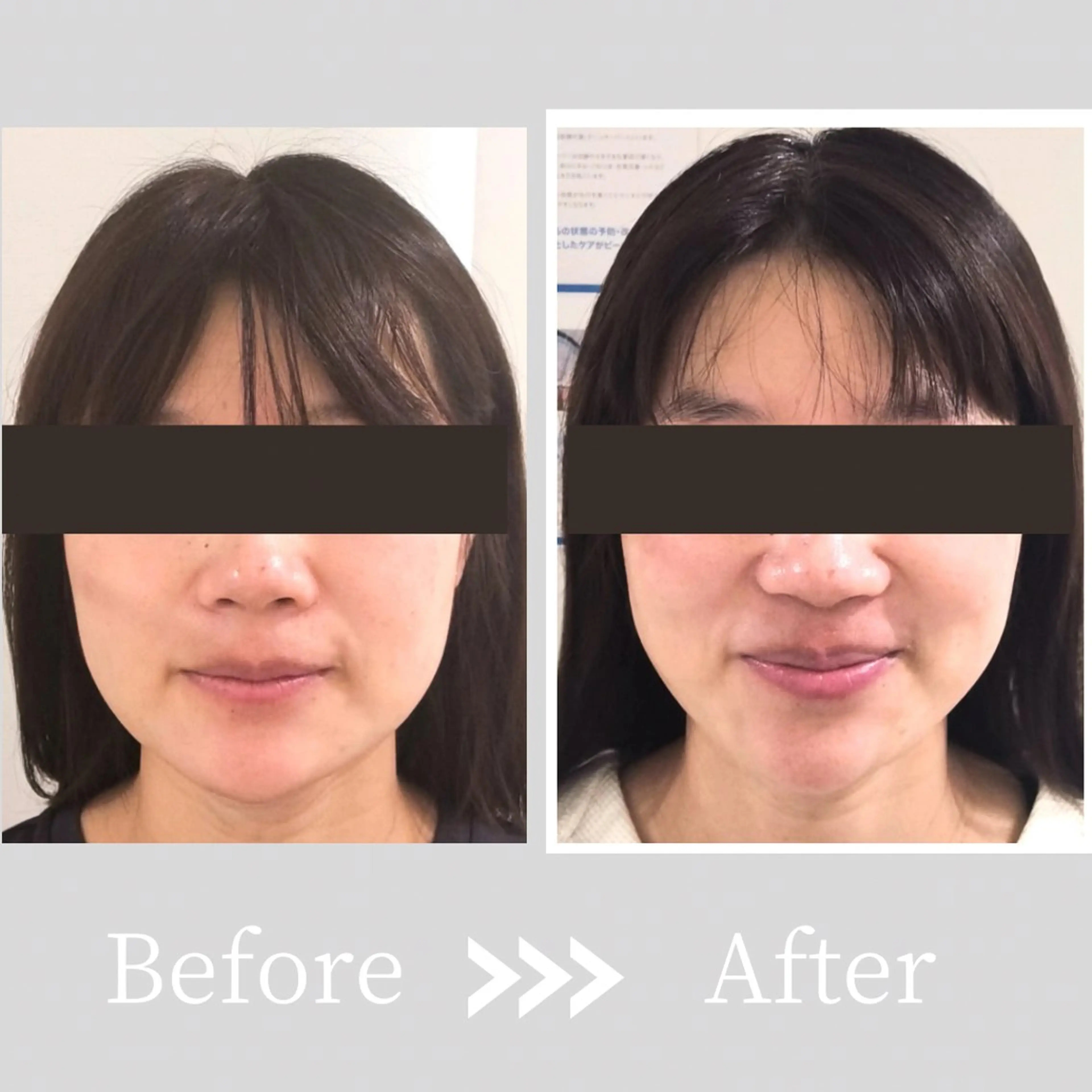 小顔・ツルツル素肌 ハリステリアのエステ・リラクイメージ