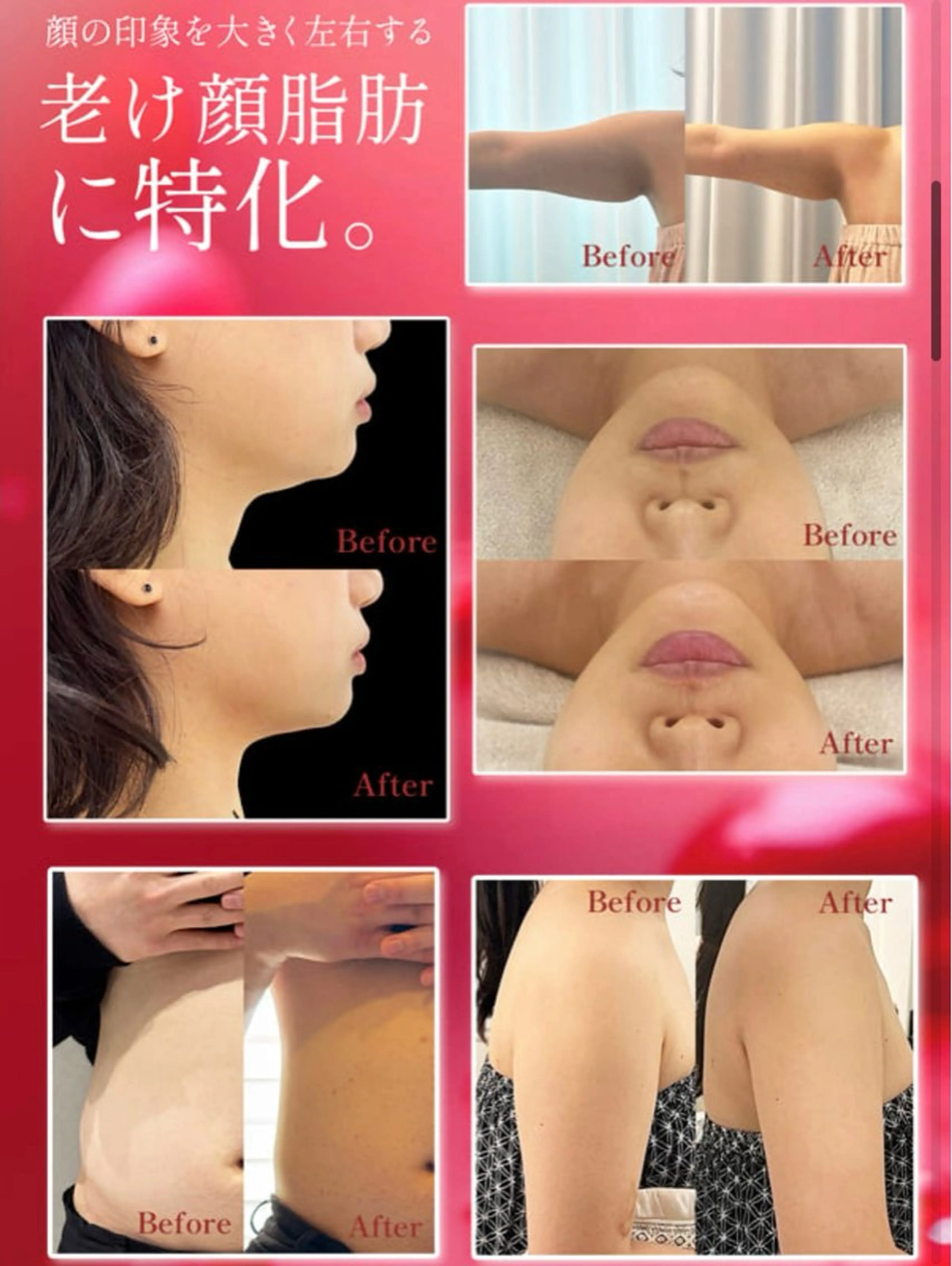 脂肪を溶かす!!REDSHOT❤️の写真