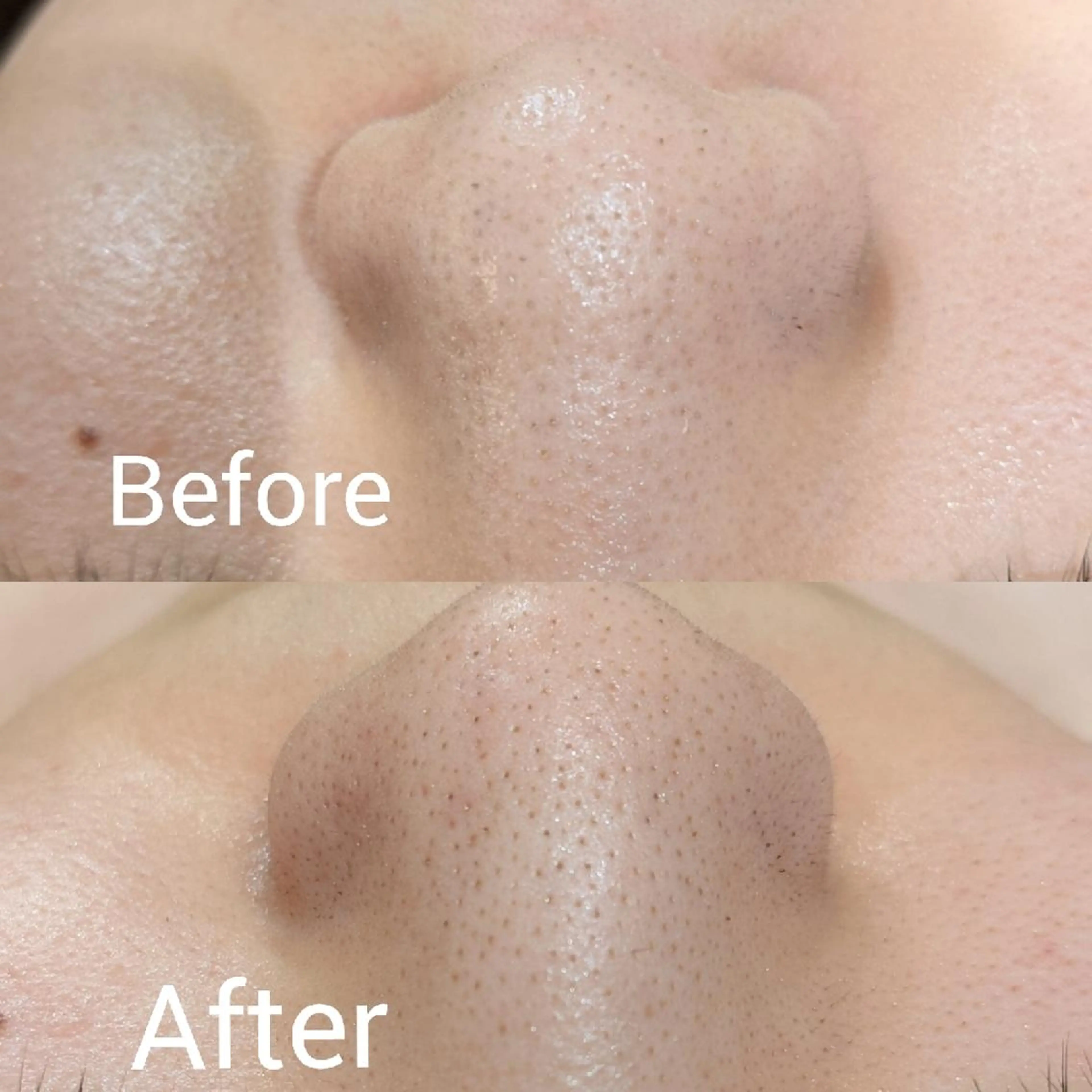 ﾌｪｲｼｬﾙｴｽﾃ ﾗﾄｩｰﾙ伊深のエステ・リラクイメージ