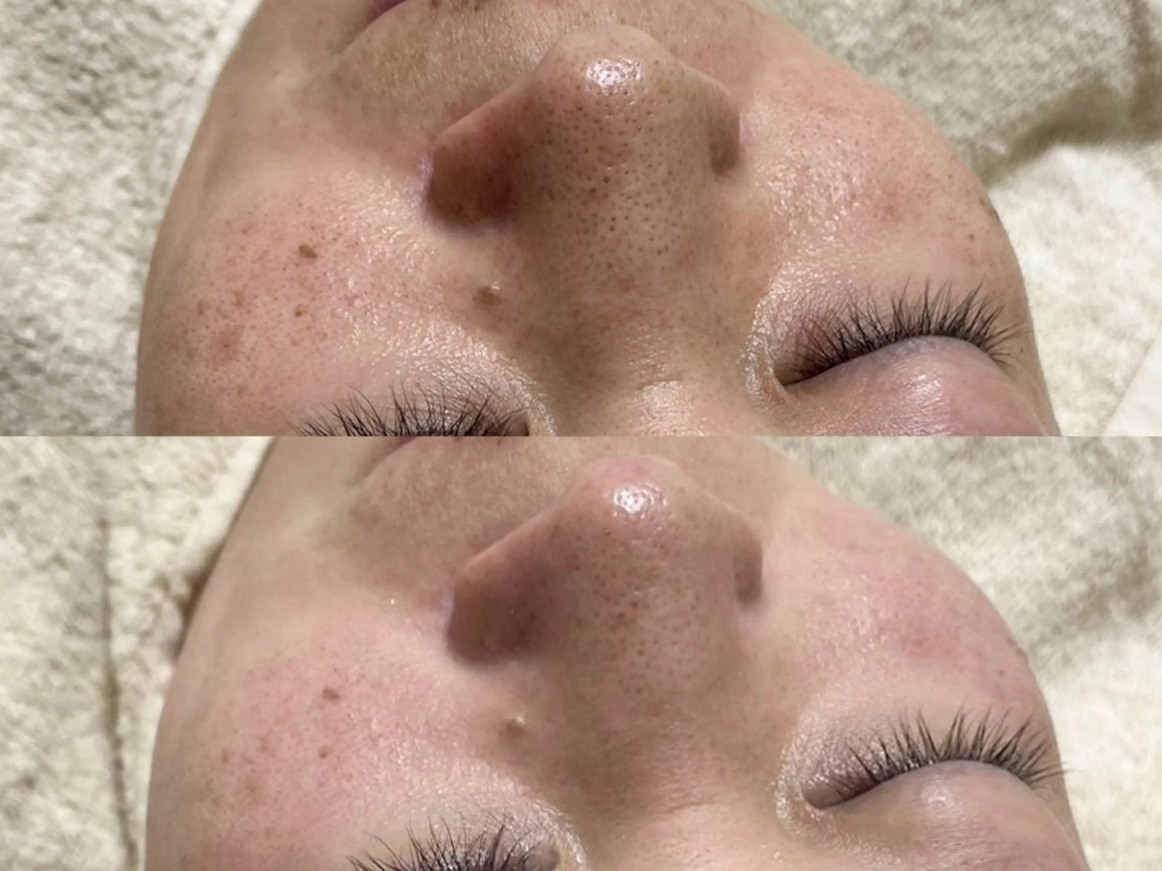 WAX脱毛/肌質改善 眉毛とお肌のサロンのエステ・リラクイメージ