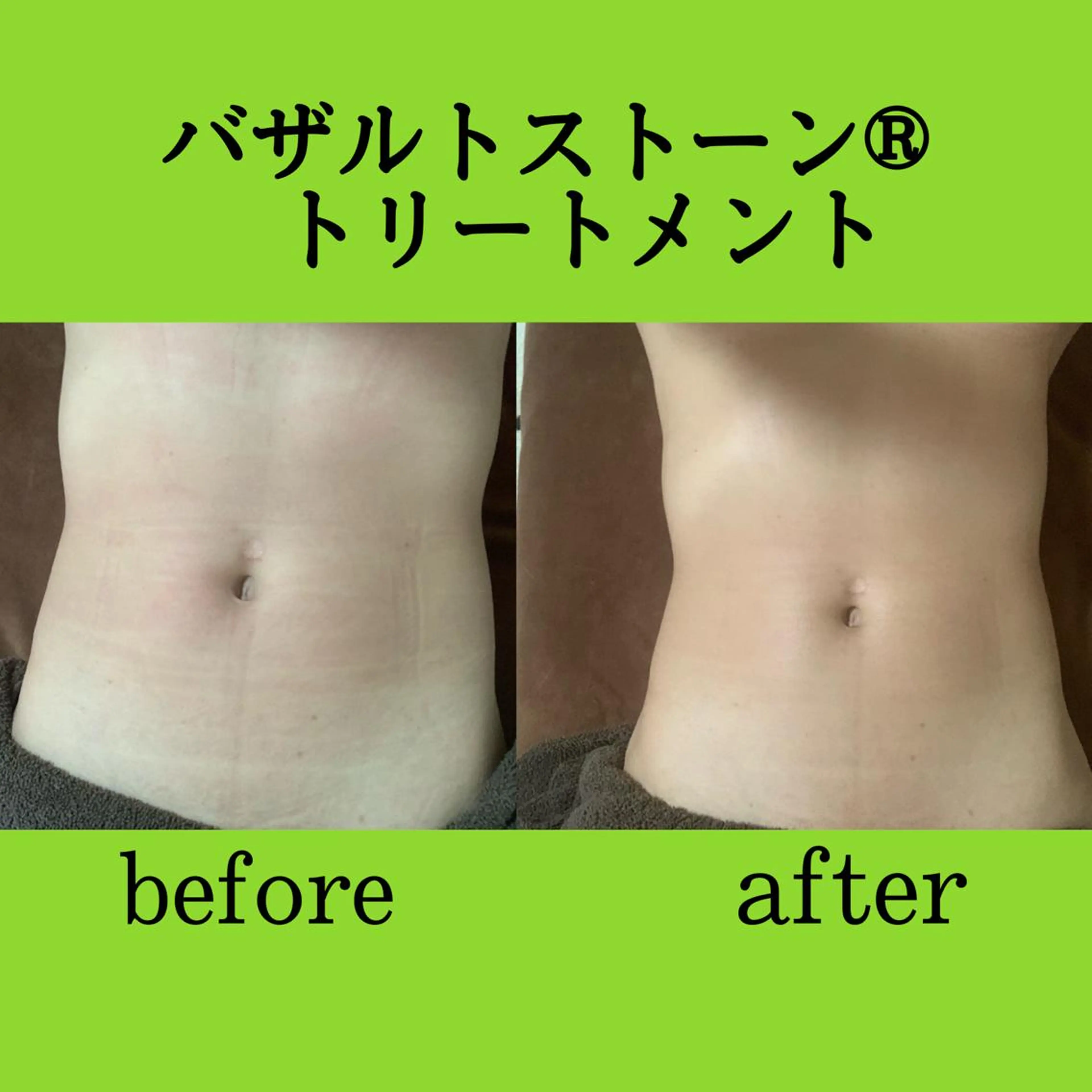 エステ リラク ビューティーサロンLEMO所属・ビューティーサロン Lemoのエステ・リラクイメージ