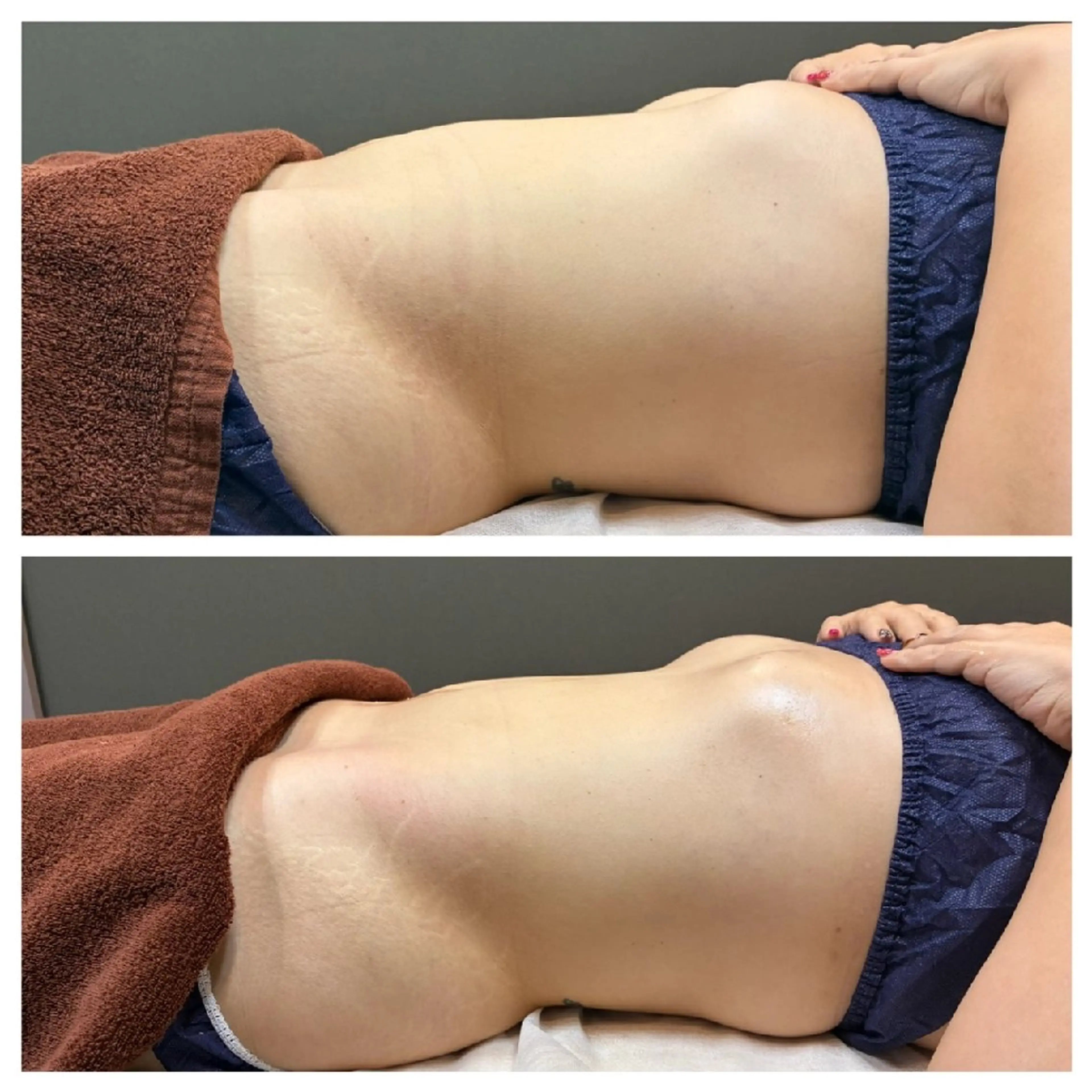 エステ jj toda beauty所属・JJ  Aiのネイルデザイン