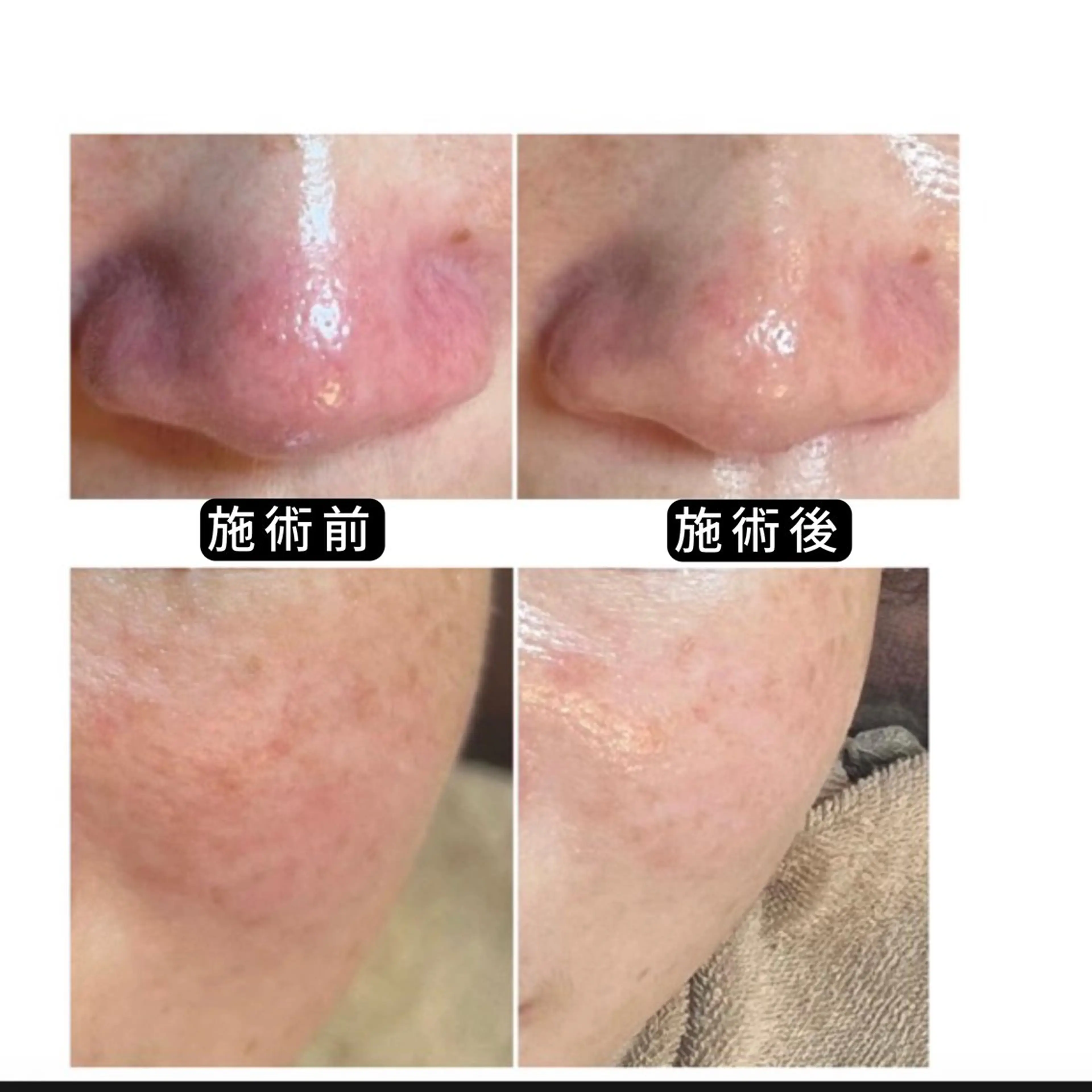 エステ リラク 渋谷 小顔美容鍼 専門サロン YZのエステ・リラクイメージ