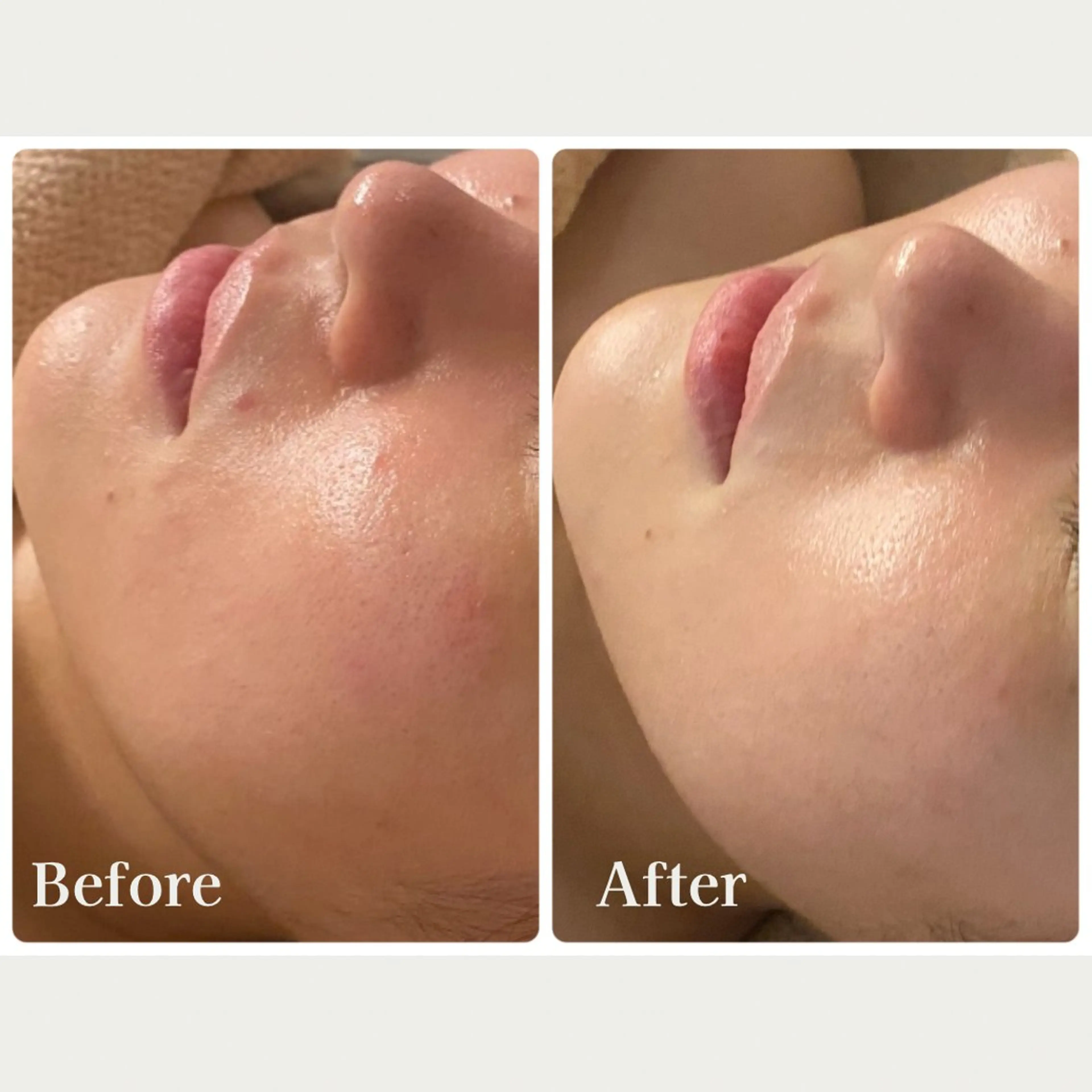 ＼脳疲労ケア70分／【ドライヘッドスパ・耳・首・肩・顔・デコルテ・背中・二の腕】 +肌ケアピーリング付きの写真