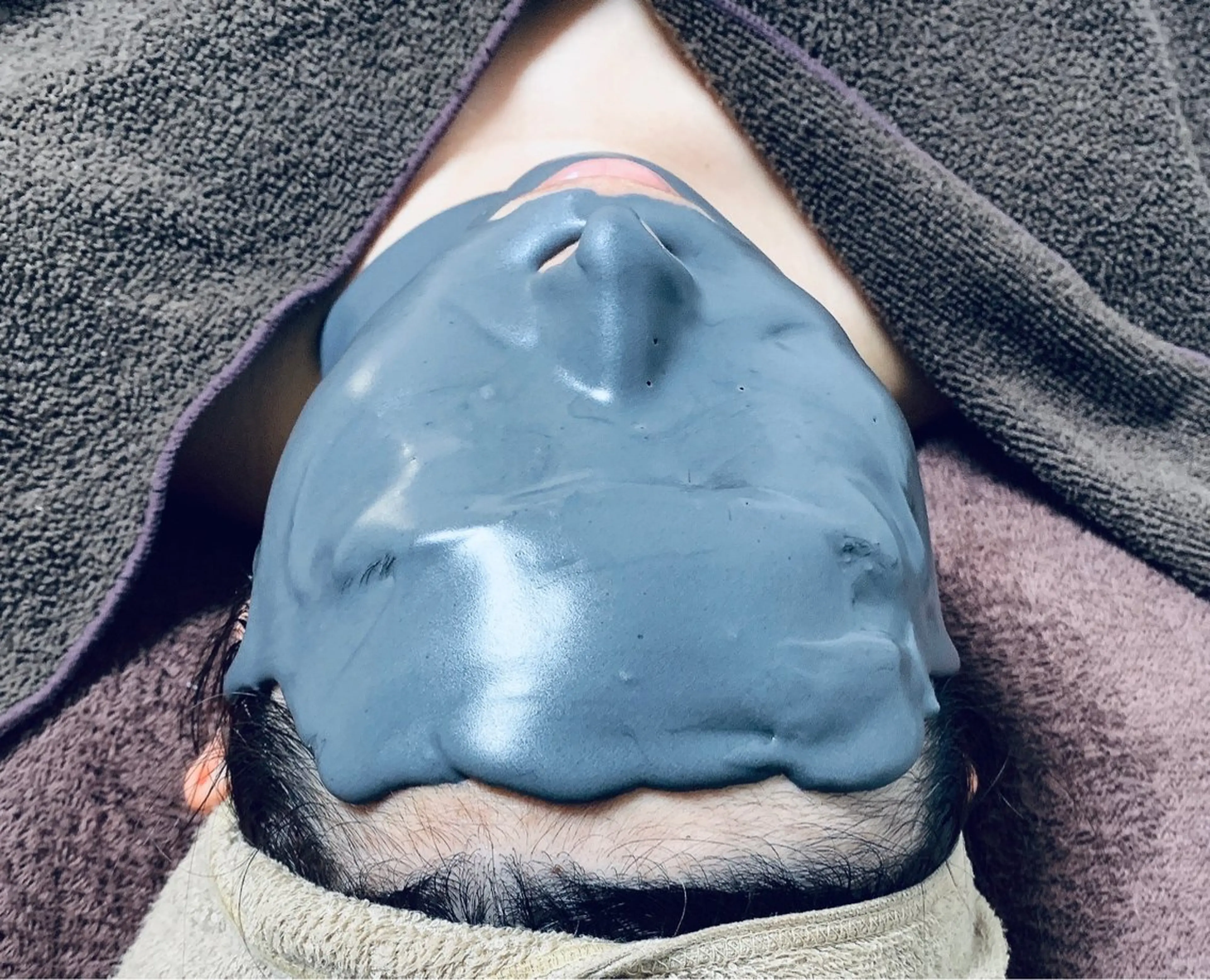 毛穴悩みの方におすすめメニュー🩶✨本格スペシャルケアエステ＋毛穴吸引施術込➕毛穴対応生パック付きの写真