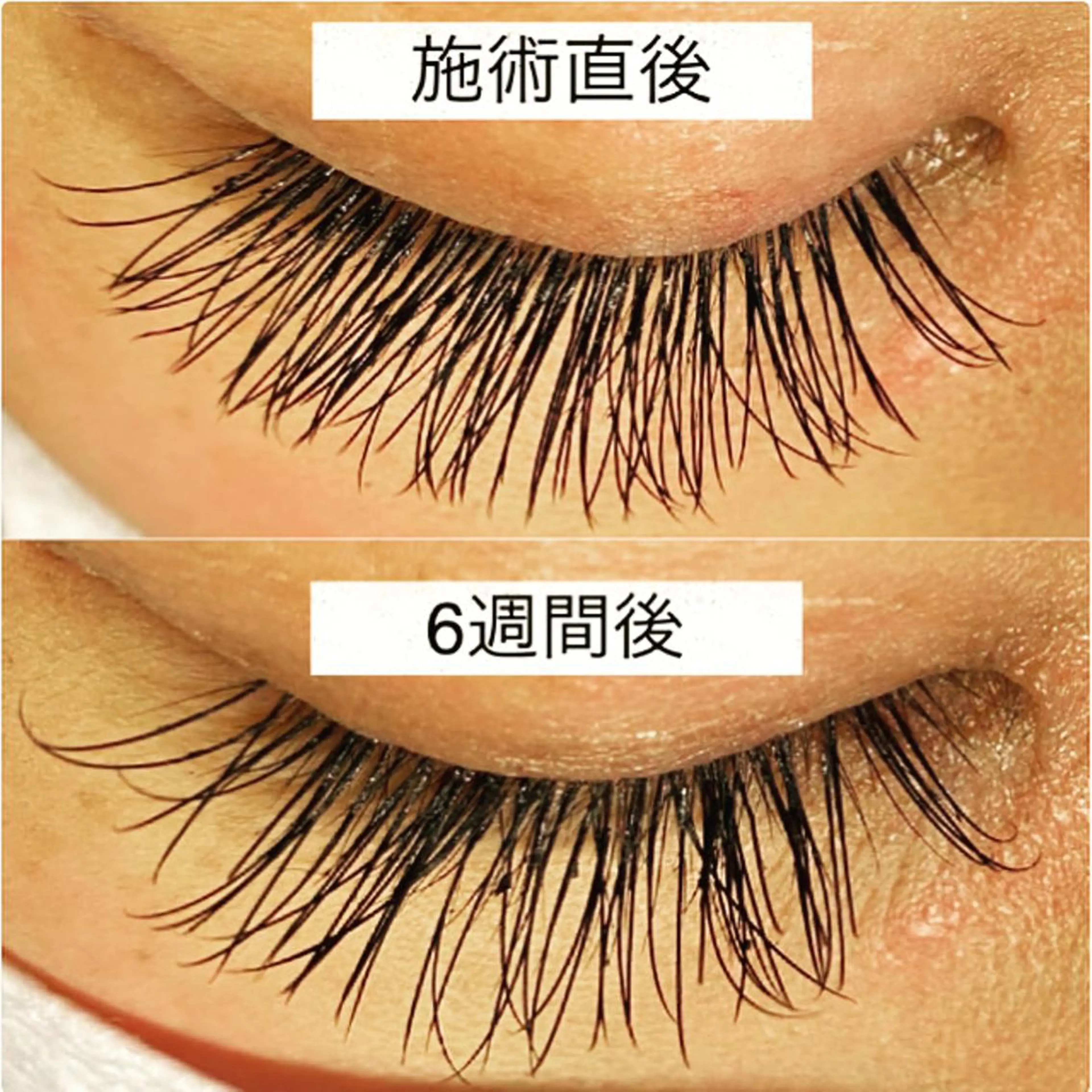 マツエク・マツパ n. asianのマツエク・マツパデザイン