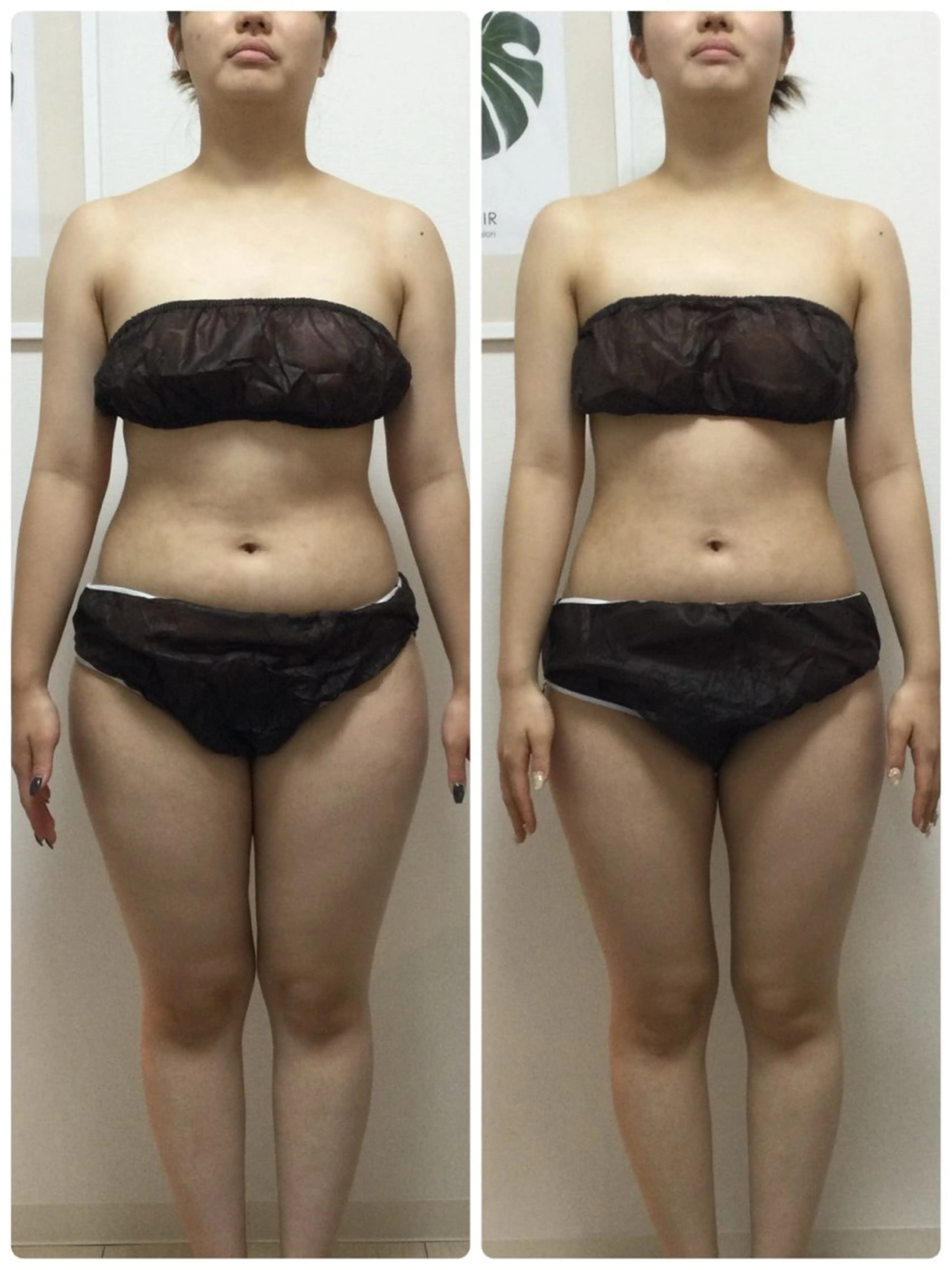 エステ リラク ESPOIR エスポワールのエステ・リラクイメージ