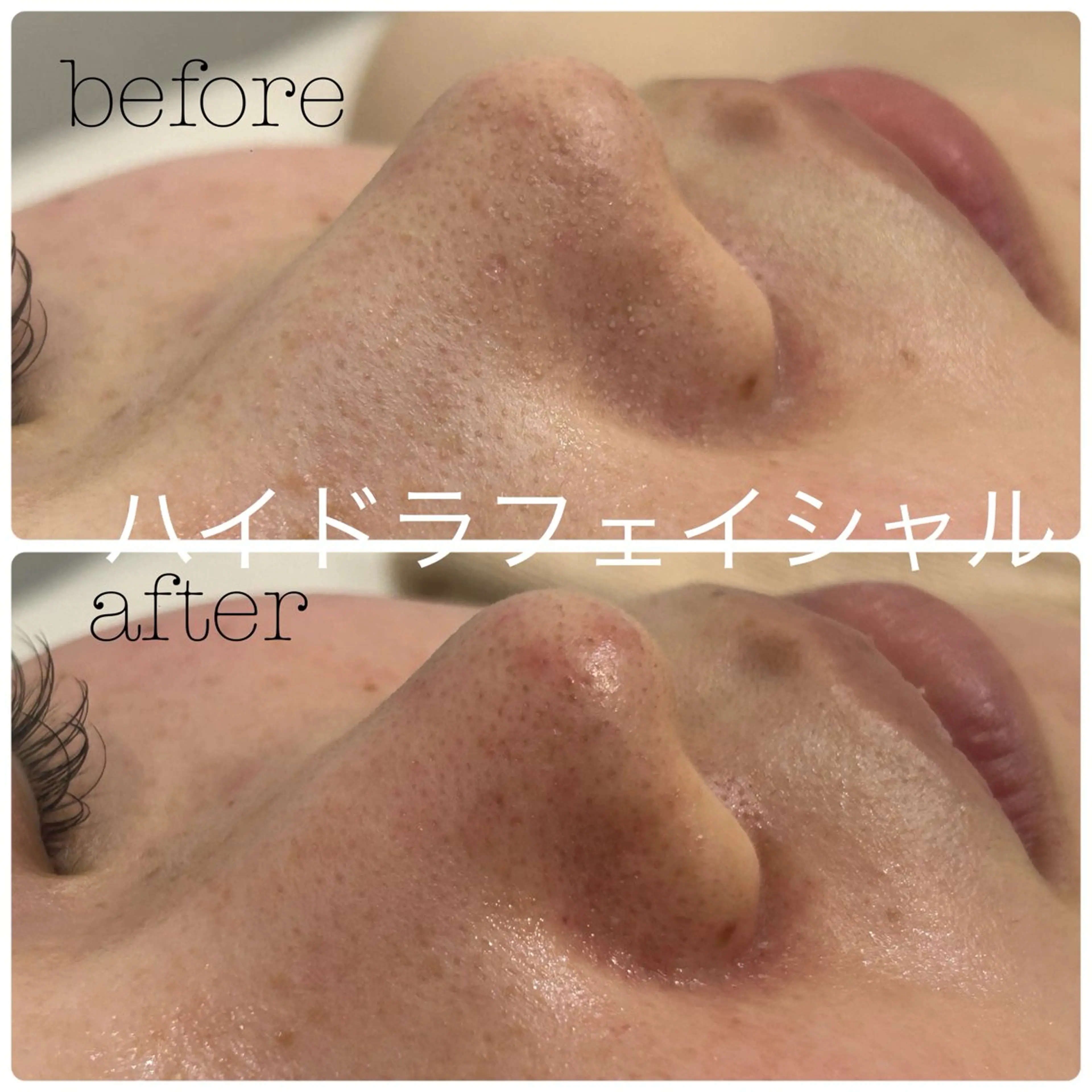 メンズ エステ フェイシャルサロン CHIARA 荒田のエステ・リラクイメージ