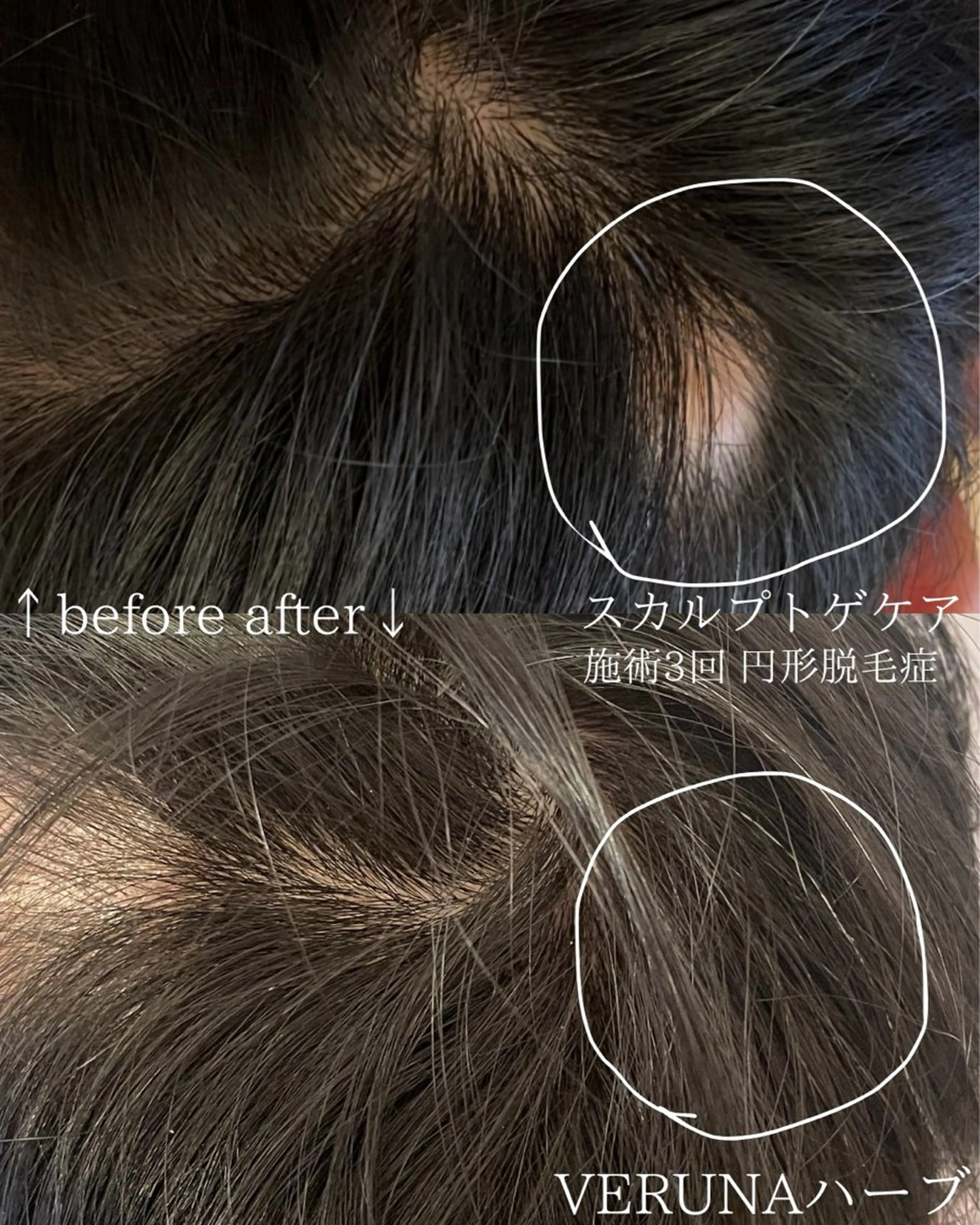 メンズ エステ リラク 毛穴改善サロン d'Alba大阪住吉のエステ・リラクイメージ