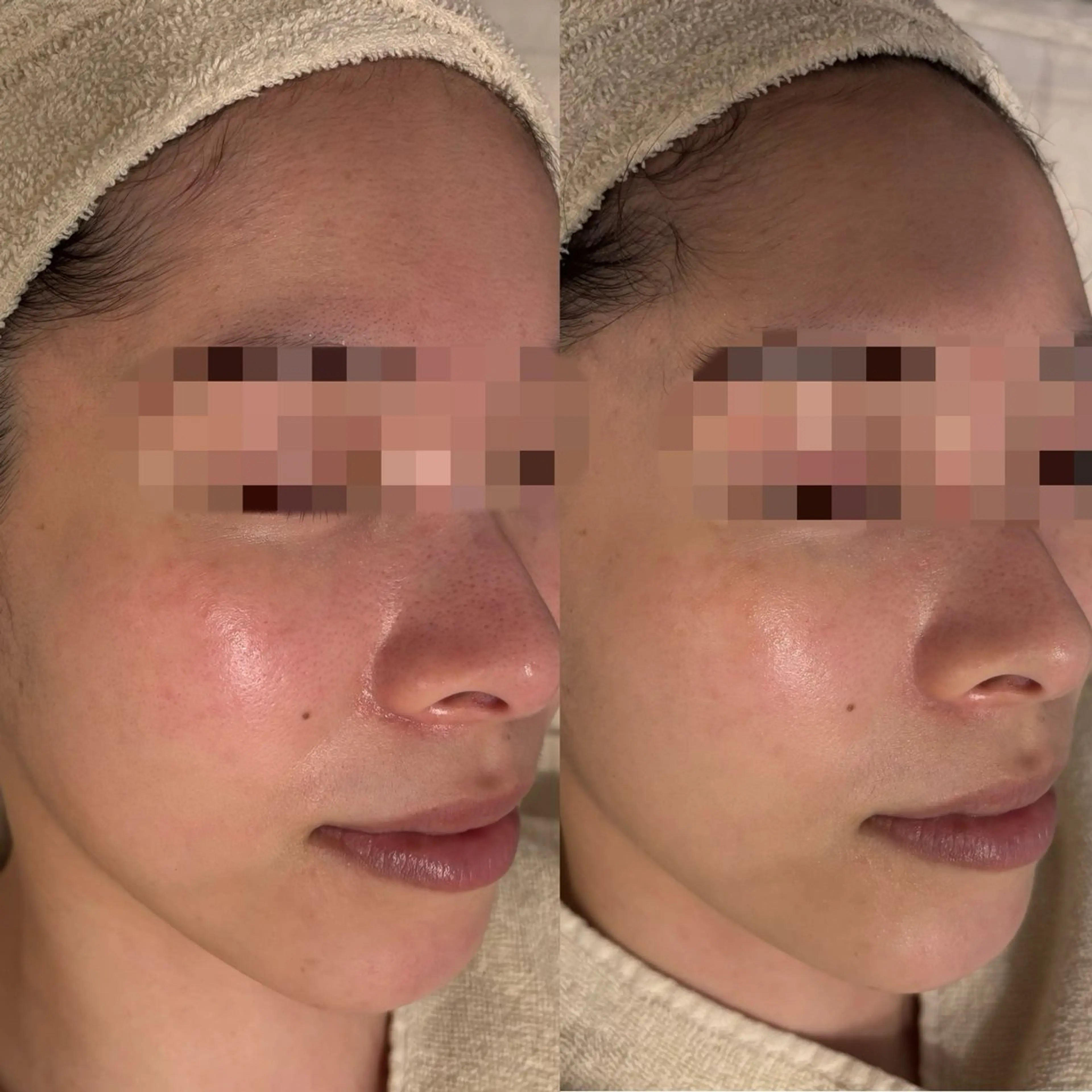 anthes /MIHOのエステ・リラクイメージ