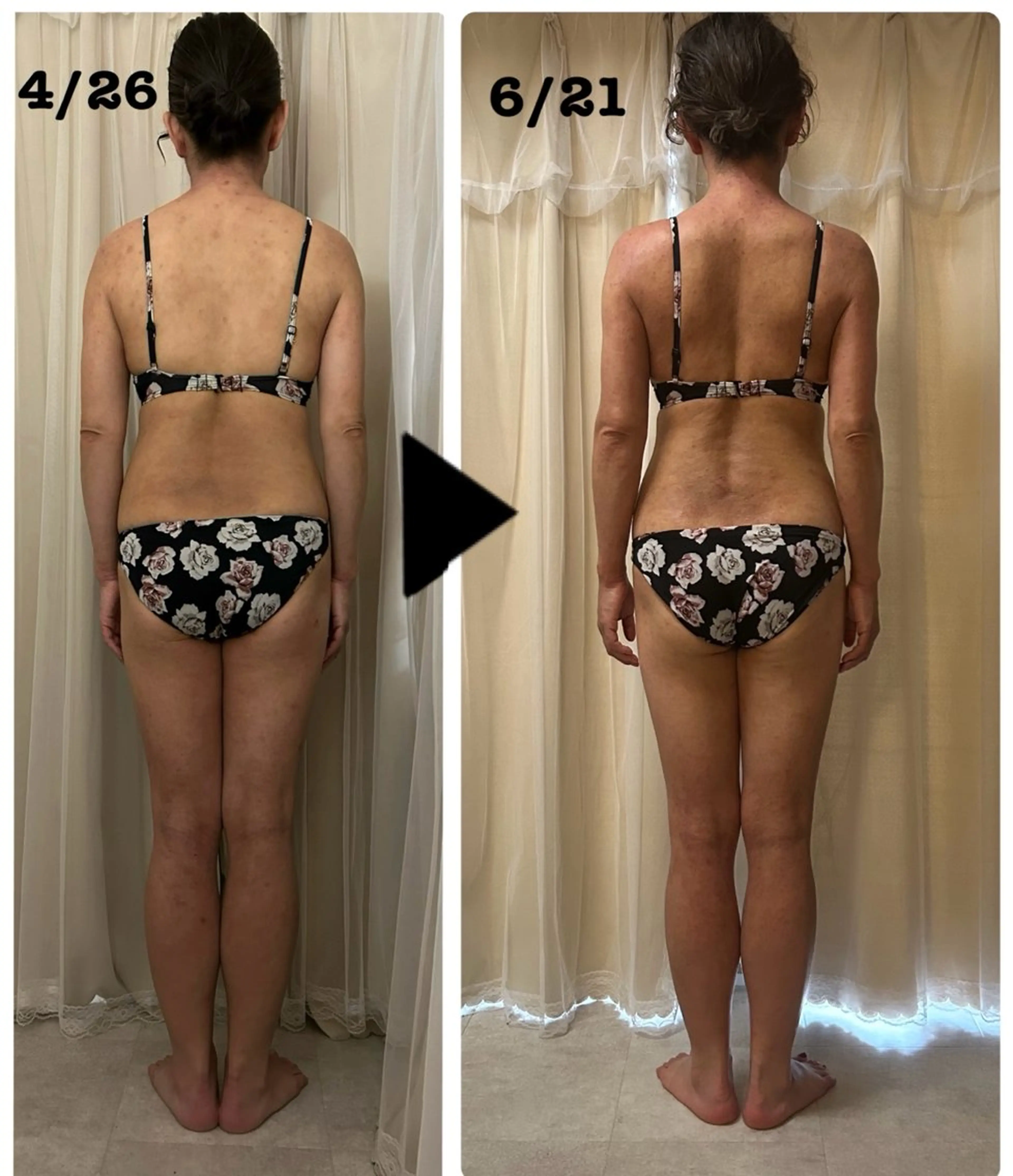 ✴︎腰痛改善・くびれ作り✴︎　お腹痩せ 腸骨、背骨周りを整え、理想的な綺麗な姿勢を　ヘッドスパ付の写真