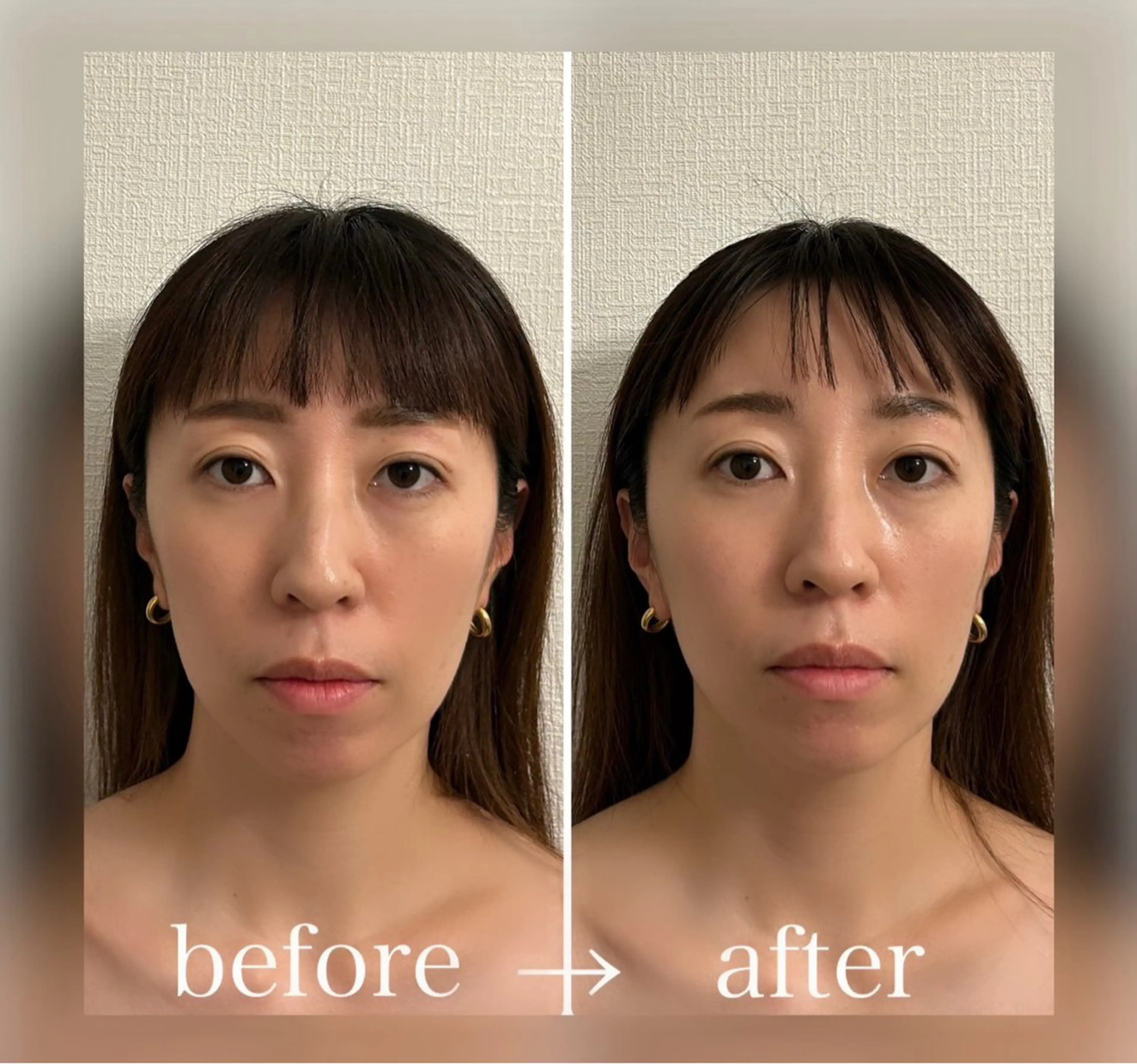 小顔セラピー LILのエステ・リラクイメージ