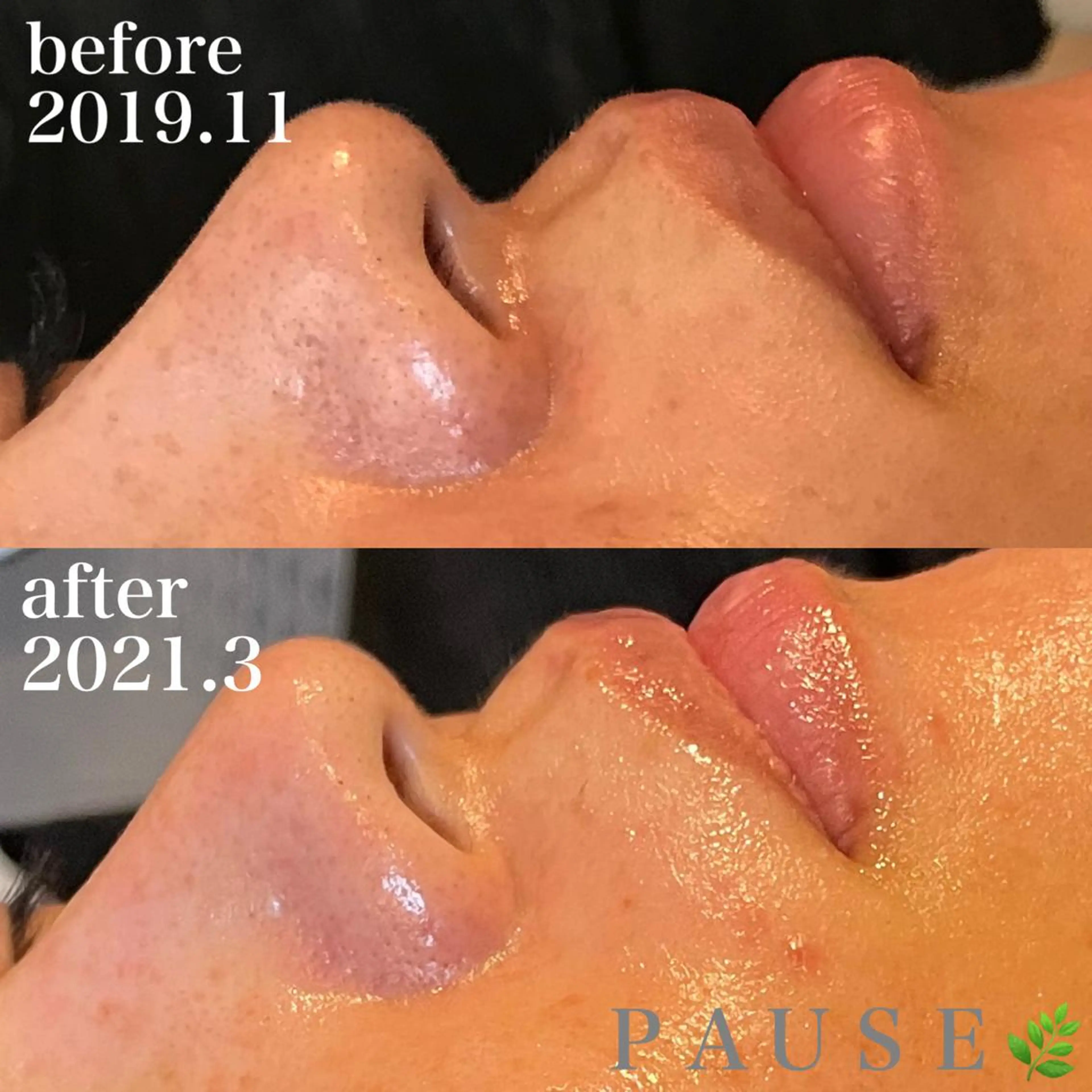 エステ 浜野 恵美のエステ・リラクイメージ