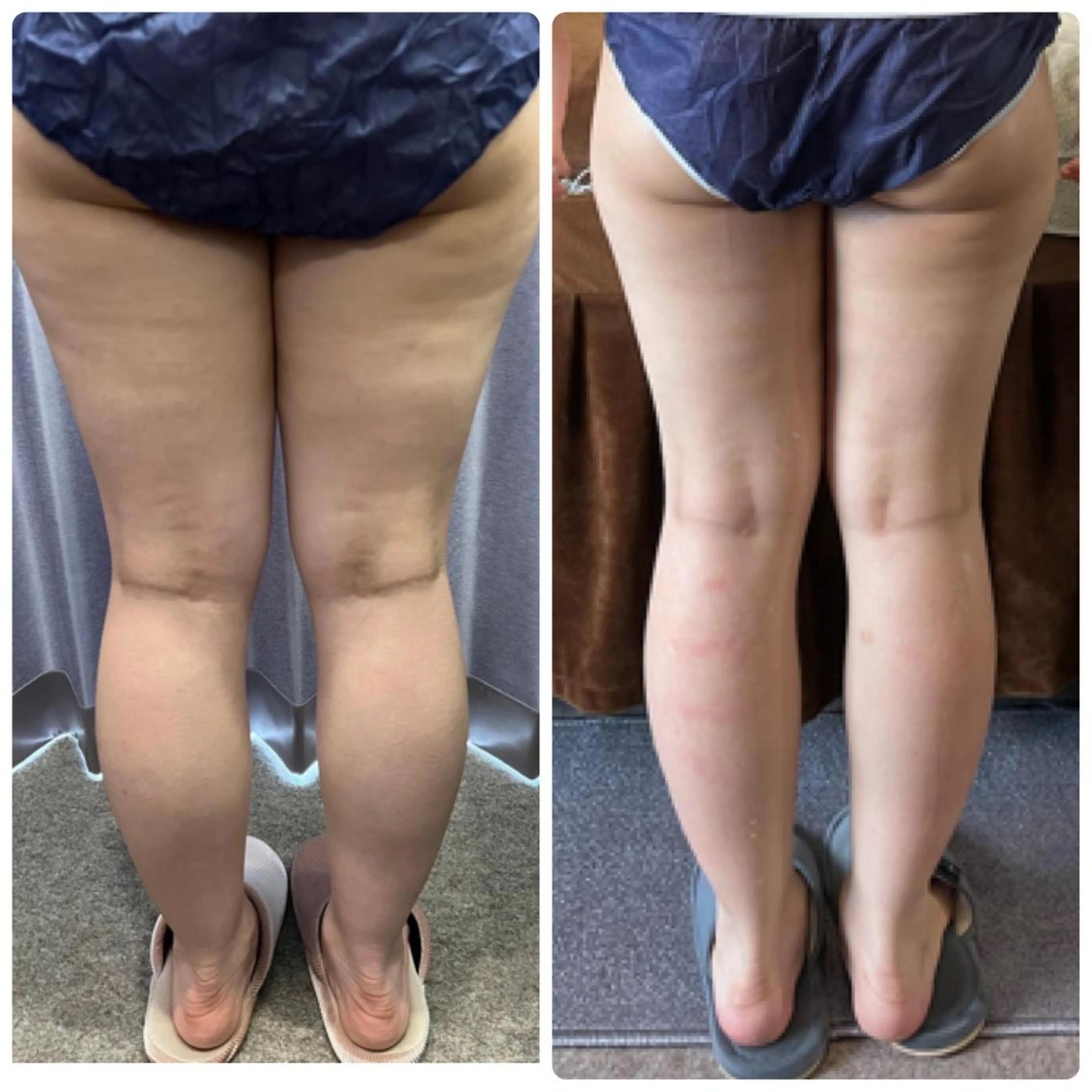 エステ 池田 紀香のエステ・リラクイメージ