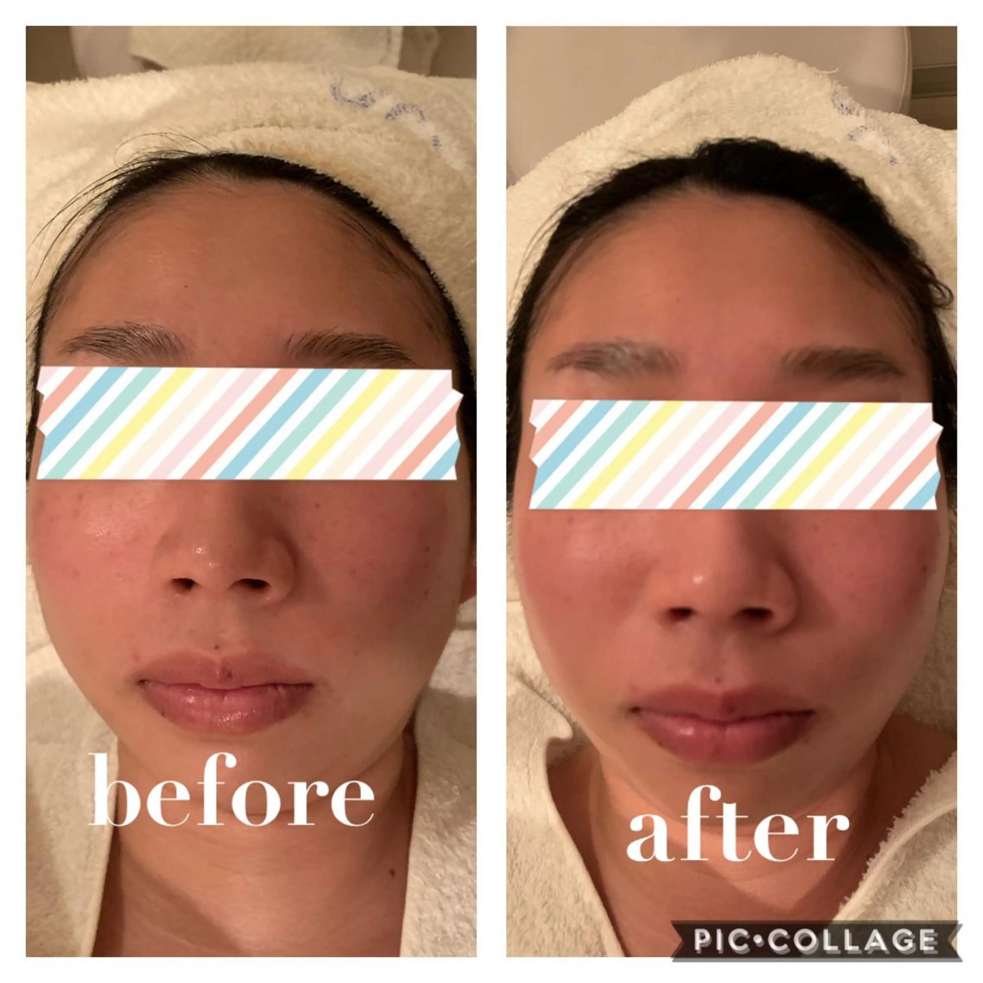 肌改善エステ/ POLA水口のエステ・リラクイメージ