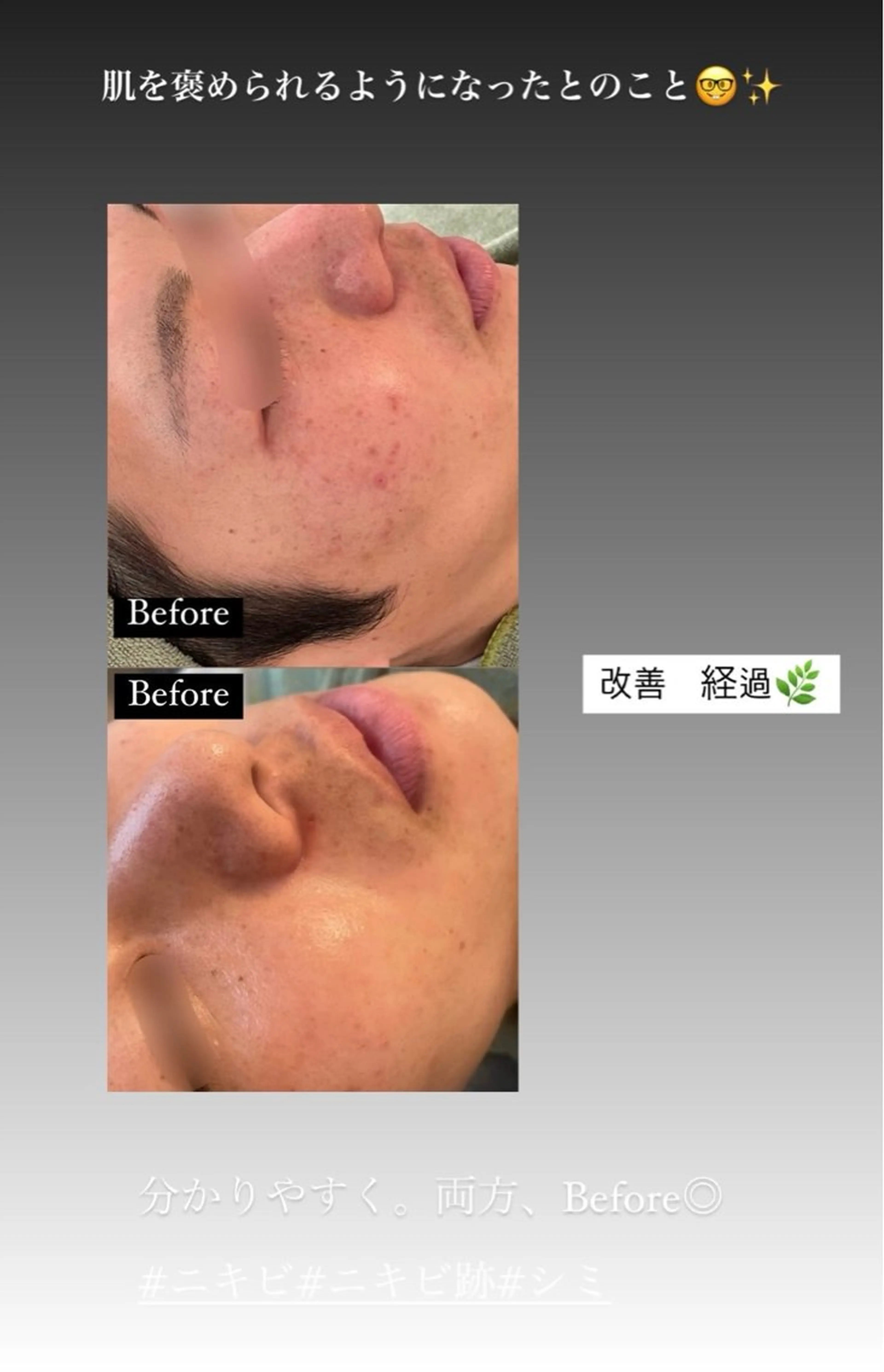 ニキビ/疲労回復ケア シェソワのエステ・リラクイメージ