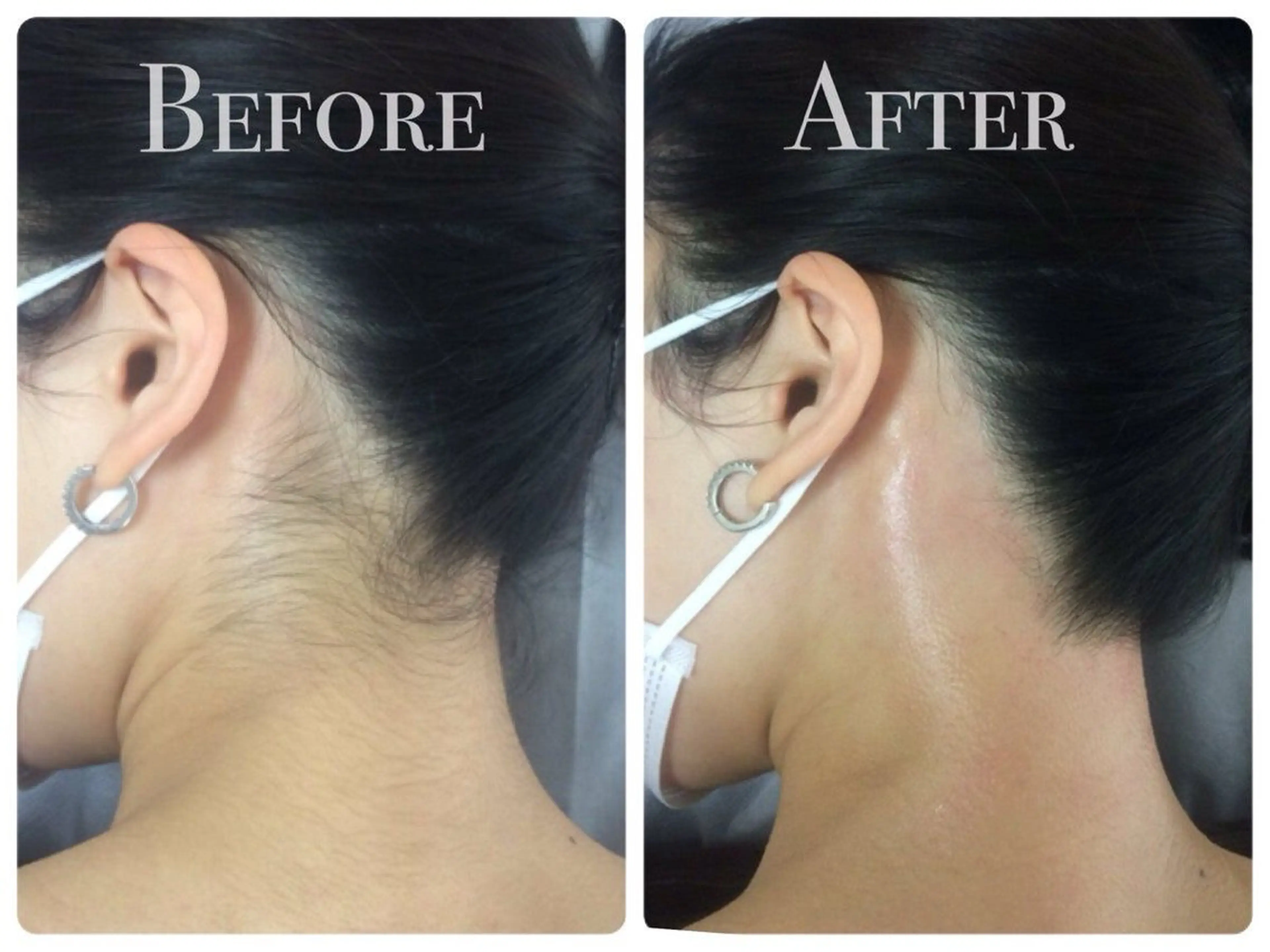 Lam..肌質改善 専門 女性専用サロンのエステ・リラクイメージ