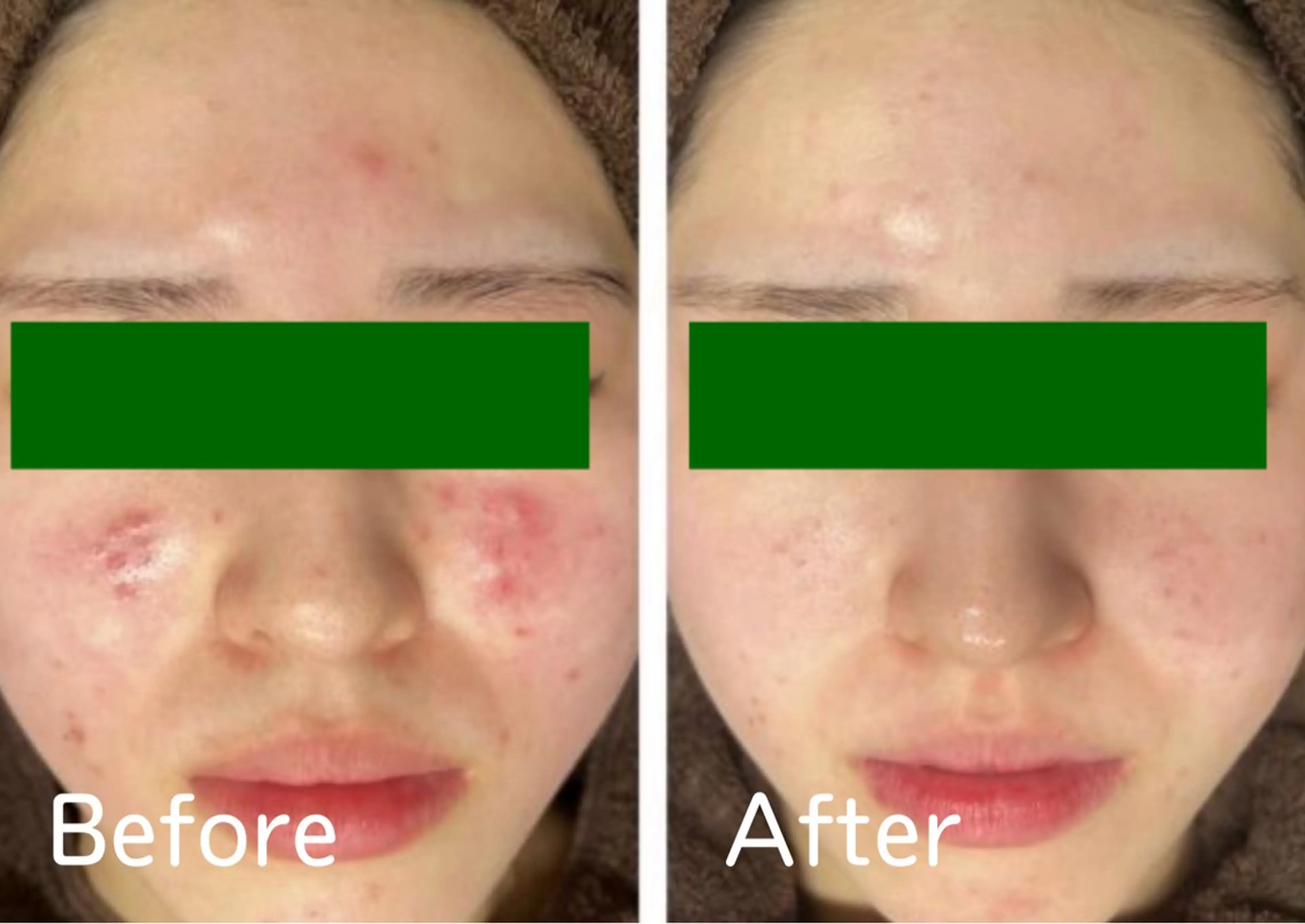 フェイシャル＆痩身 カンフリエ✨七田のその他イメージ