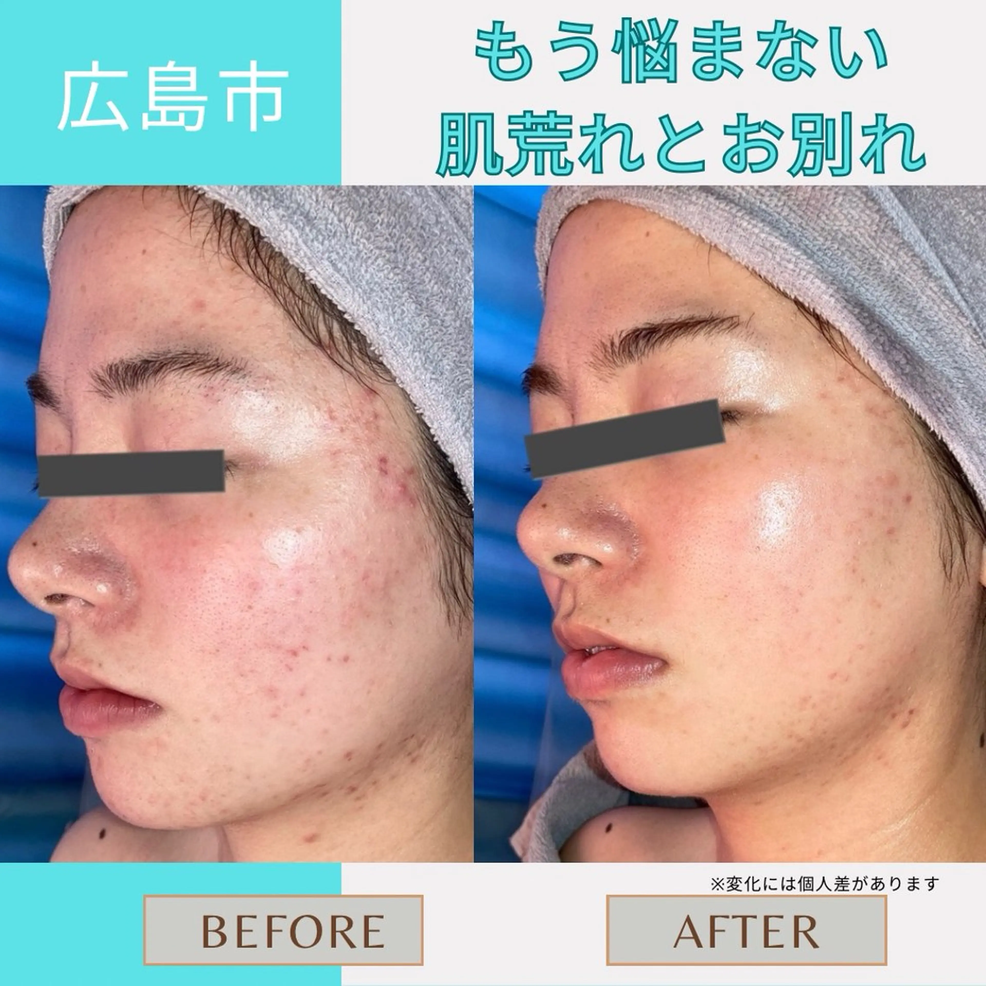 Le・Ciel フェイシャル&ボディのエステ・リラクイメージ