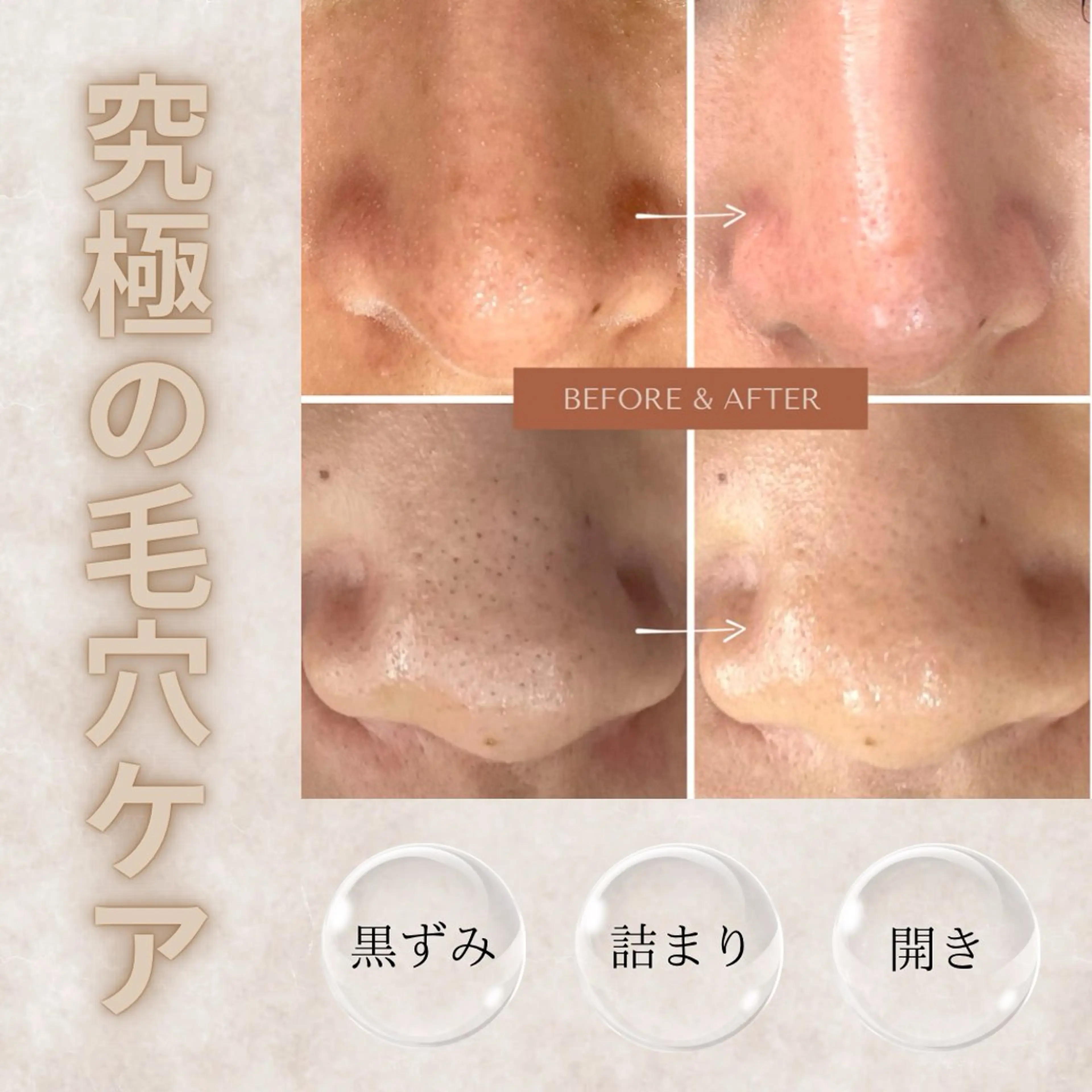 エステ 肌質改善専門サロン Bellmi/心斎橋のエステ・リラクイメージ