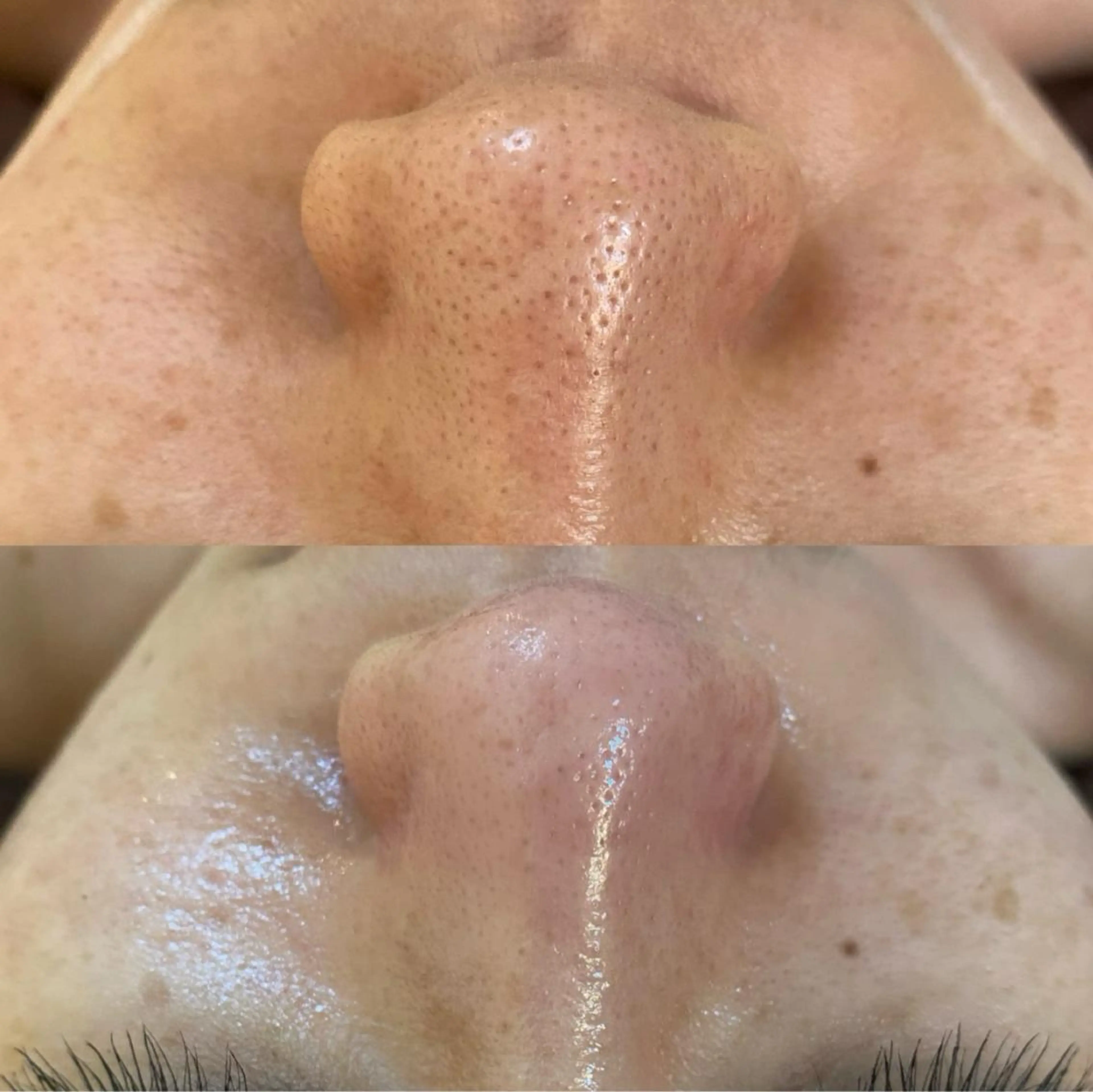 エステ リラク BELCIA福岡店 レコルトデベルシアのエステ・リラクイメージ