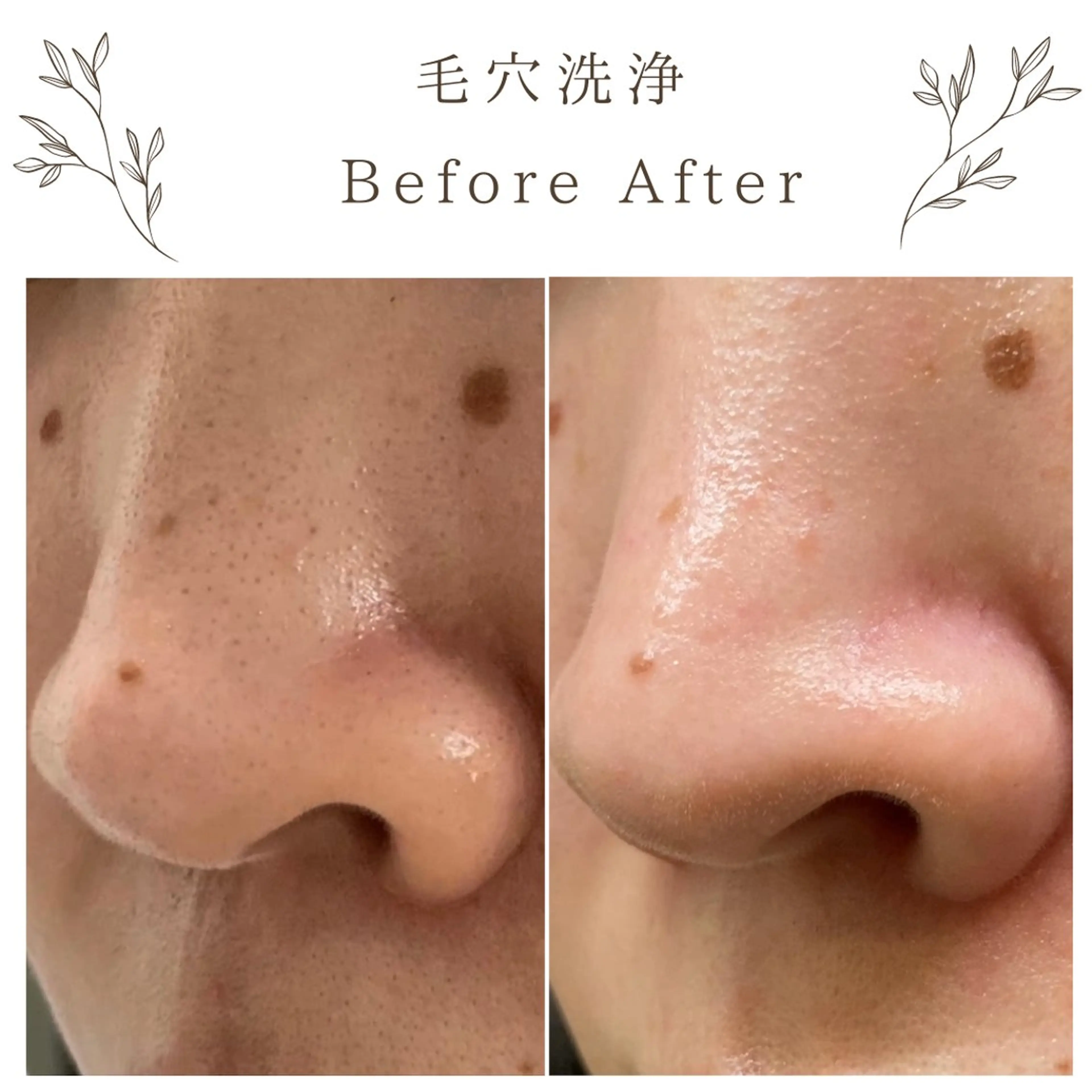 な ぎのエステ・リラクイメージ