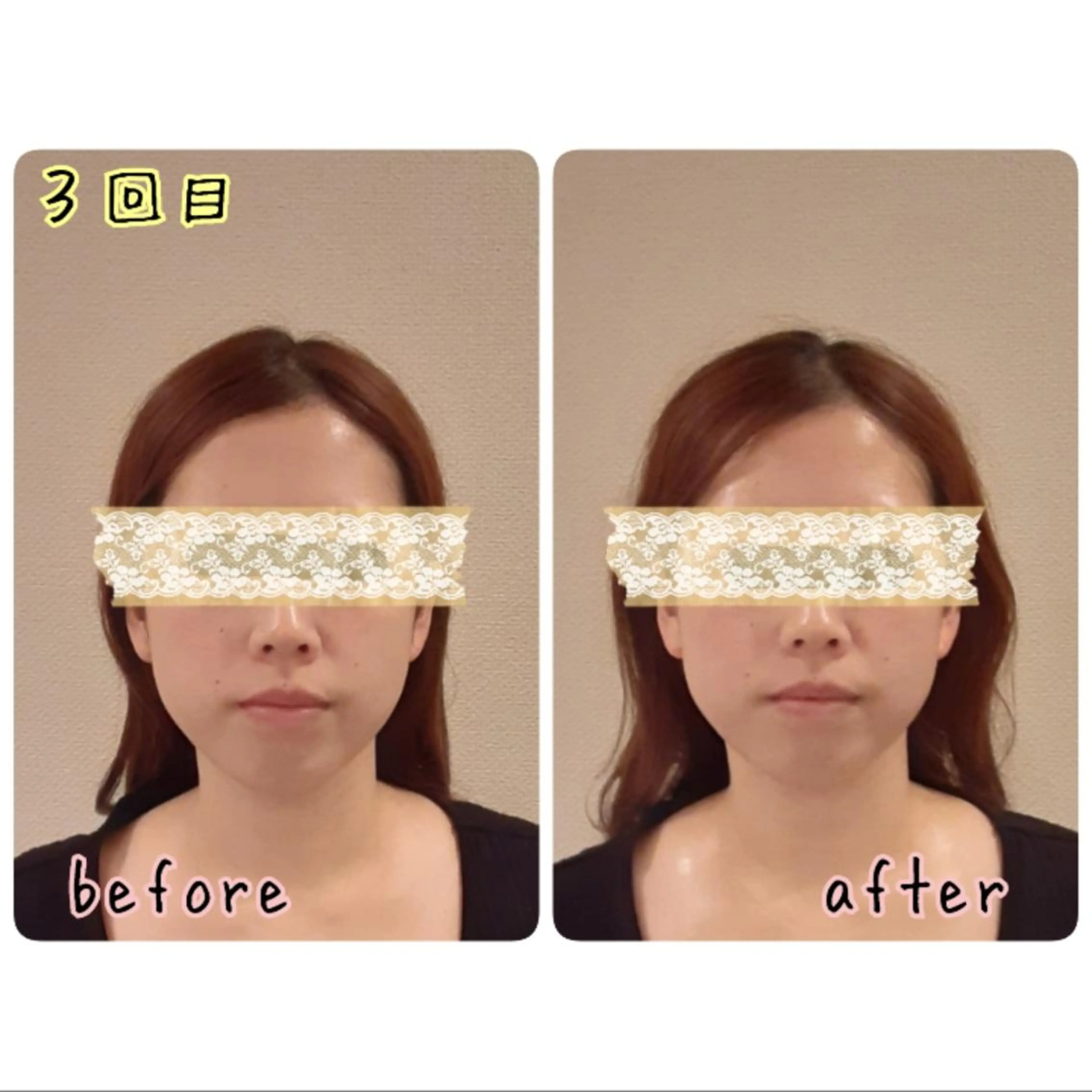 女性専門 Luna time 整体院所属・Luna time  整体院　金子ゆかのエステ・リラクイメージ