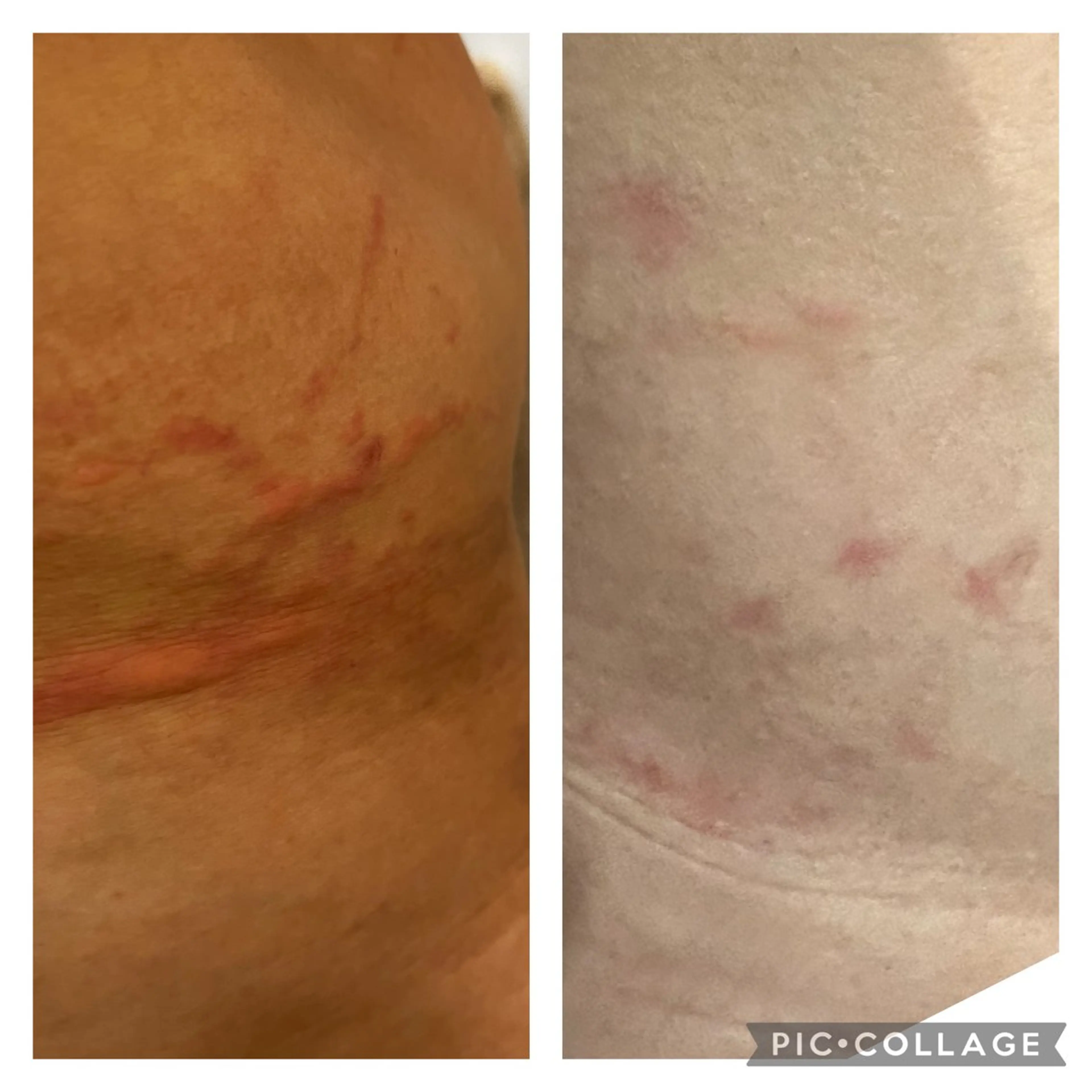 🅖🅤🅩🅔🅛 salonのエステ・リラクイメージ