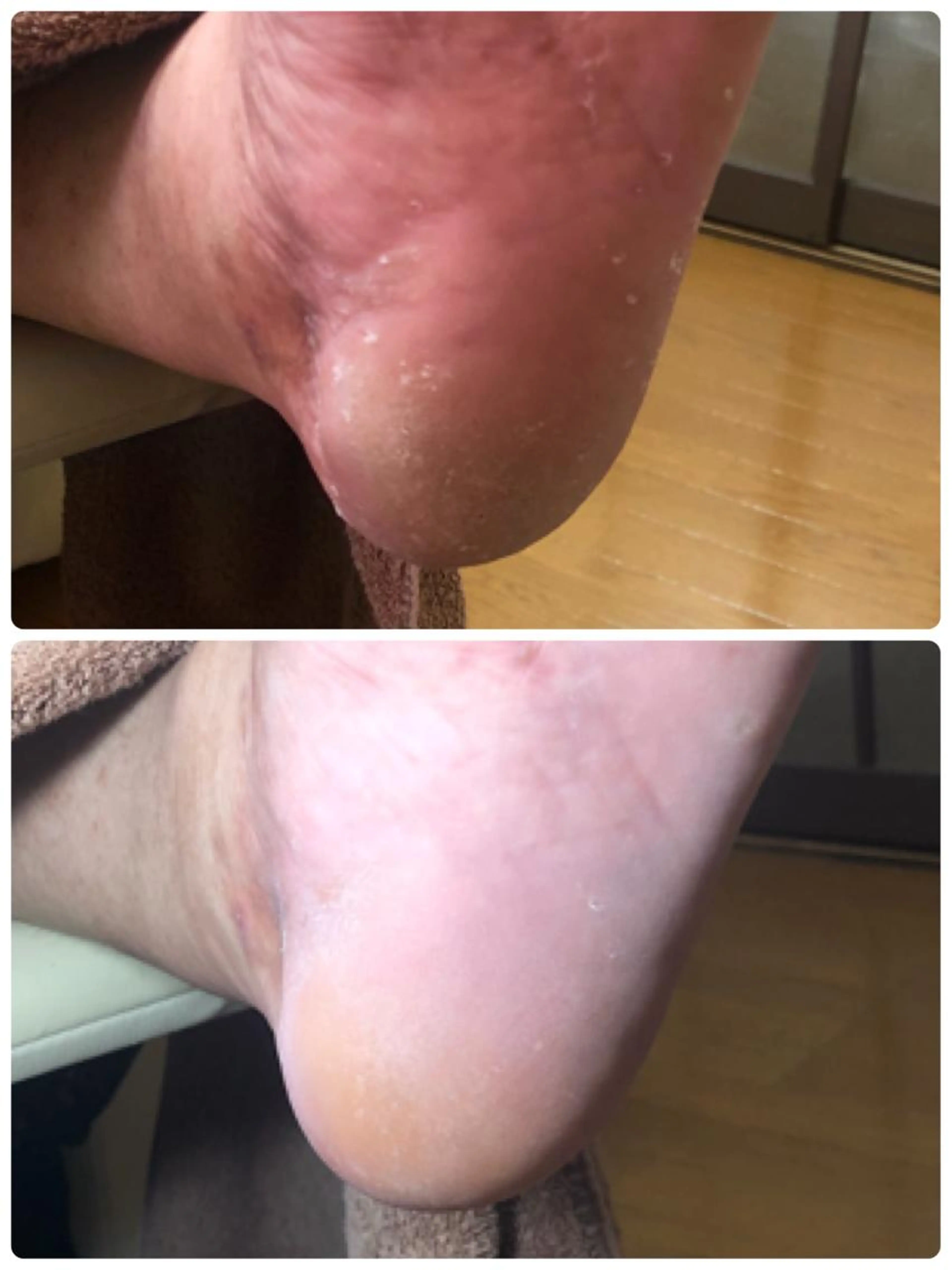 再来フットケアの写真