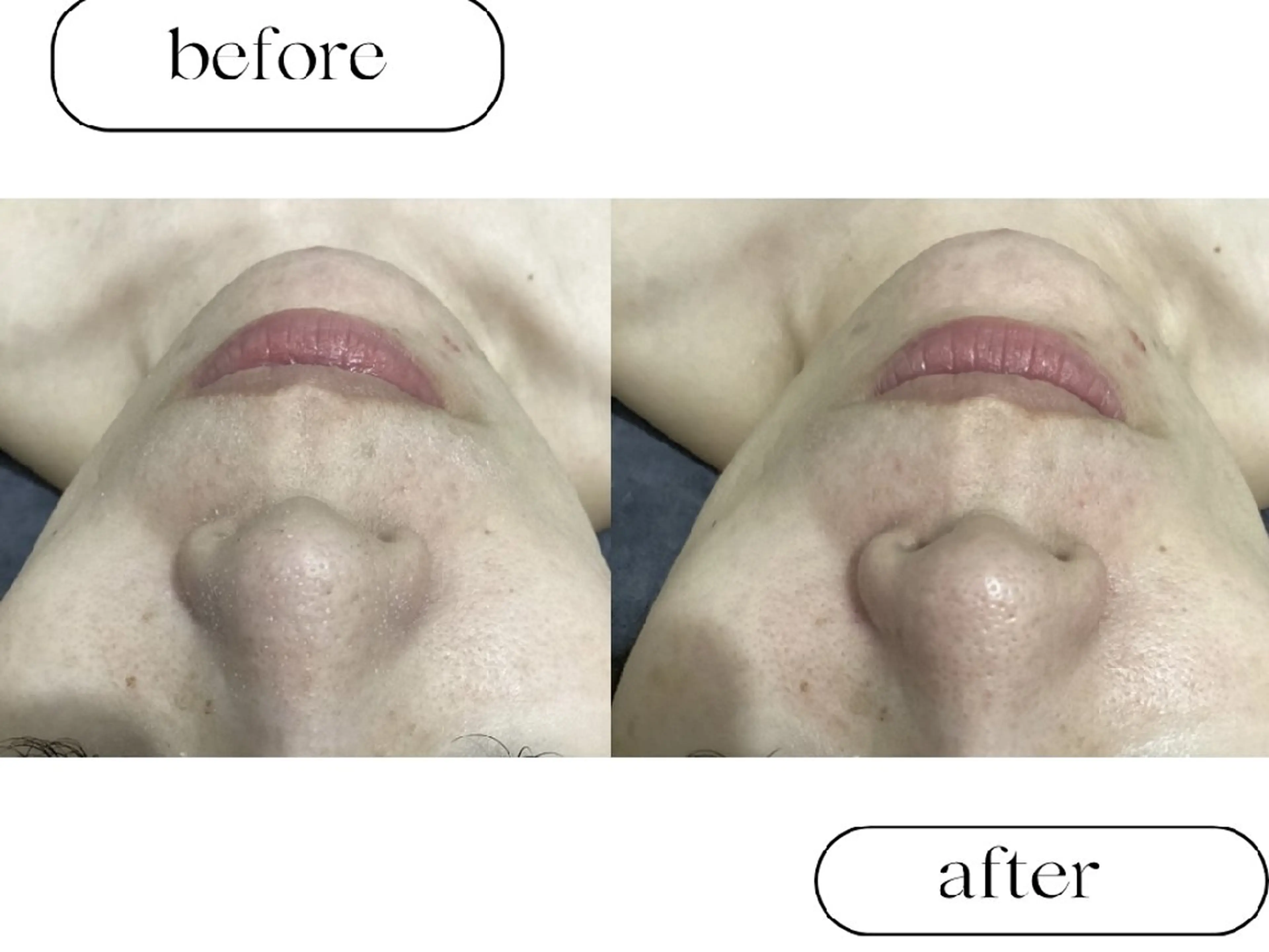 美肌専門サロン RUBONのエステ・リラクイメージ