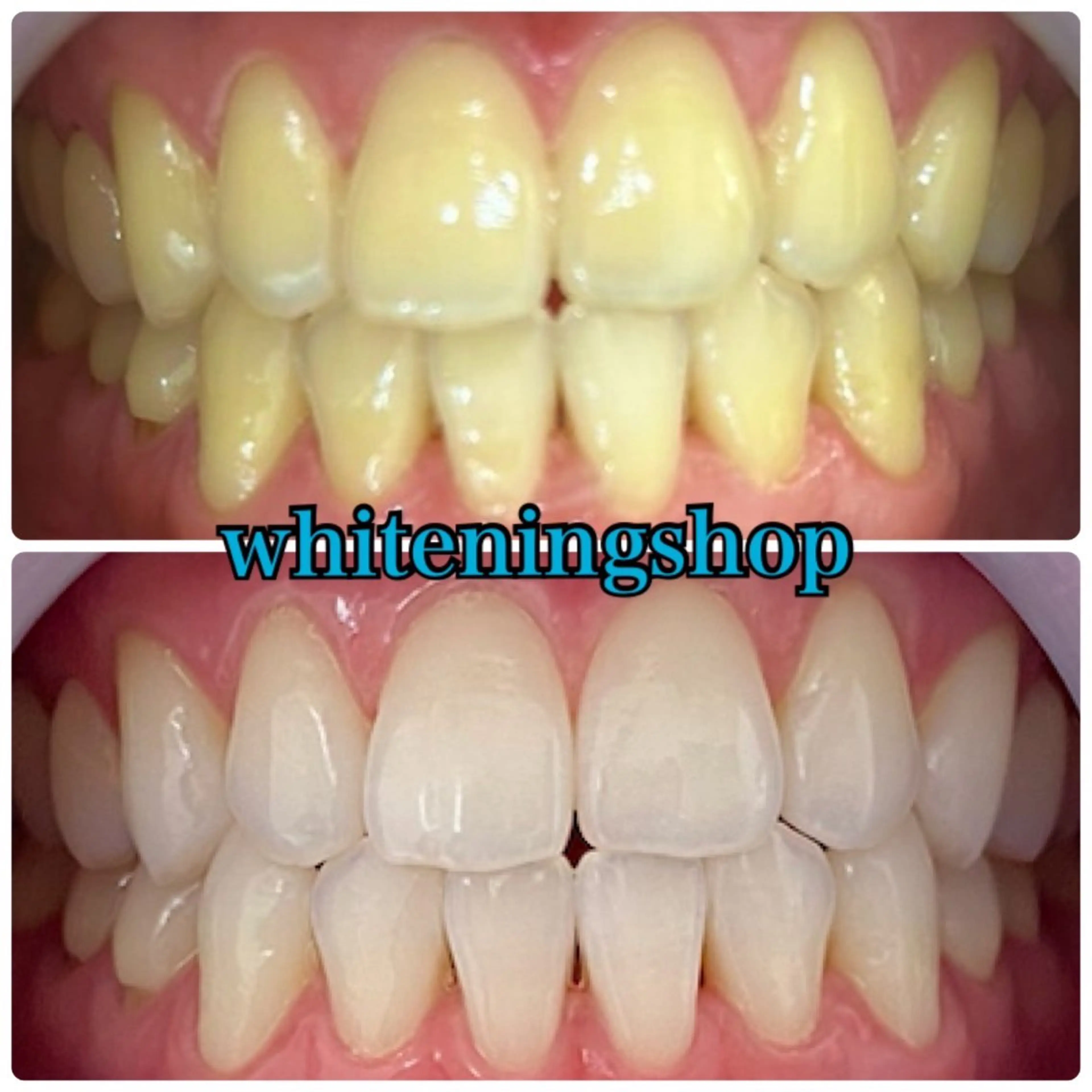 エステ リラク ホワイトニング ショップ吉祥寺店のエステ・リラクイメージ