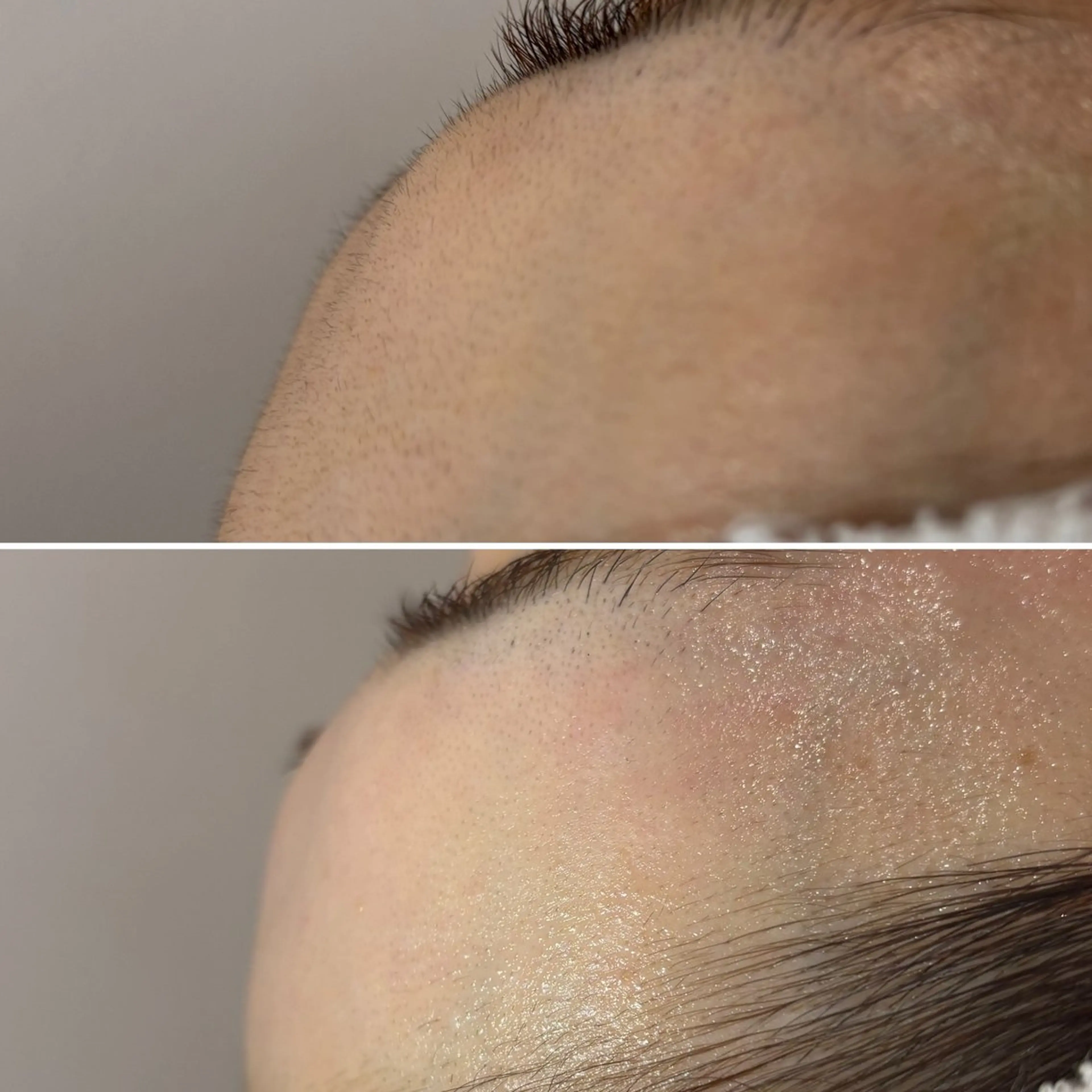 脱毛 子連れOK/枚方 眉/肌質改善サロンの眉毛・アイブロウイメージ