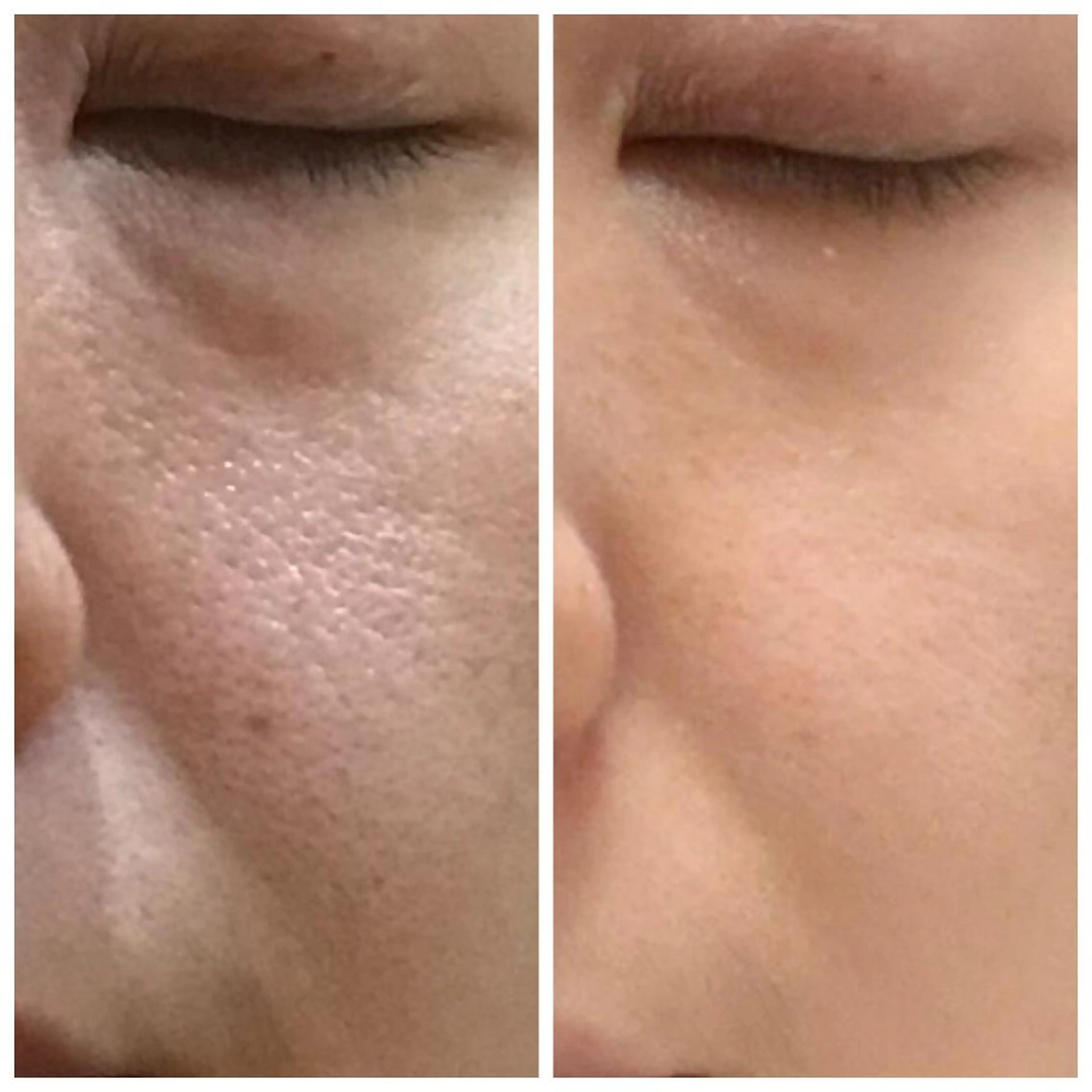 山崎 愛子のエステ・リラクイメージ