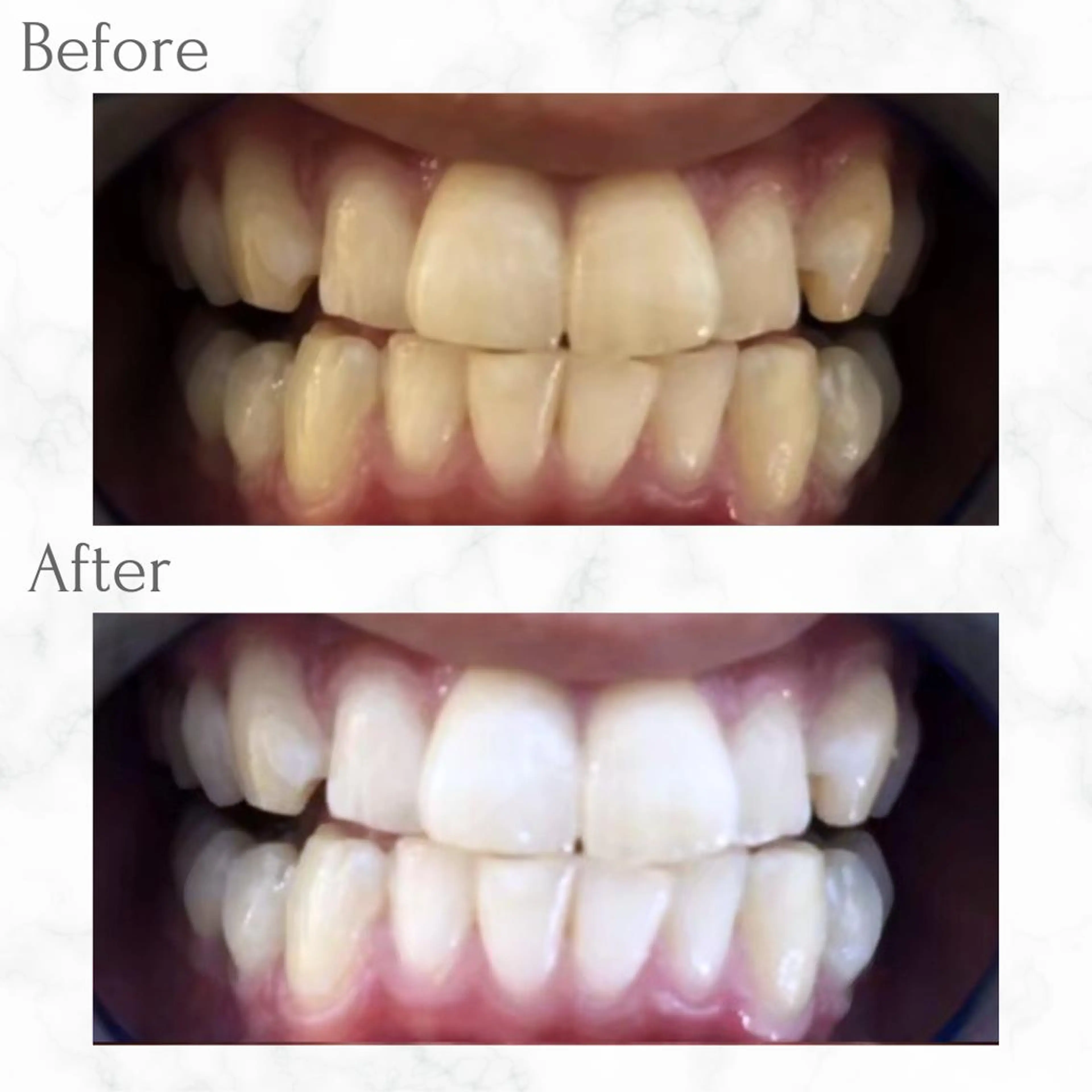 その他 エクシア天神店 💟marinのその他イメージ