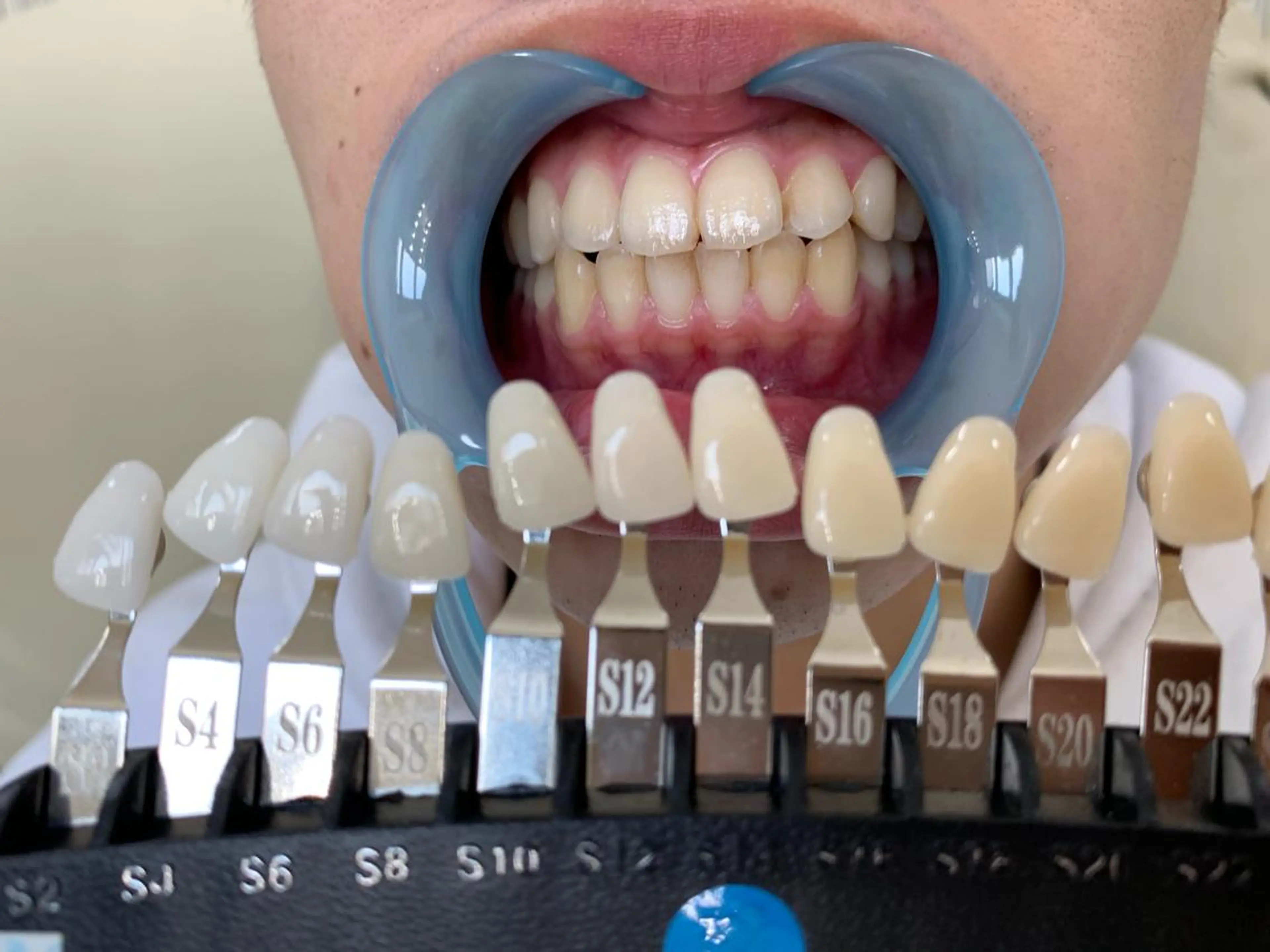 メンズ 217 ホワイトニングルームのエステ・リラクイメージ