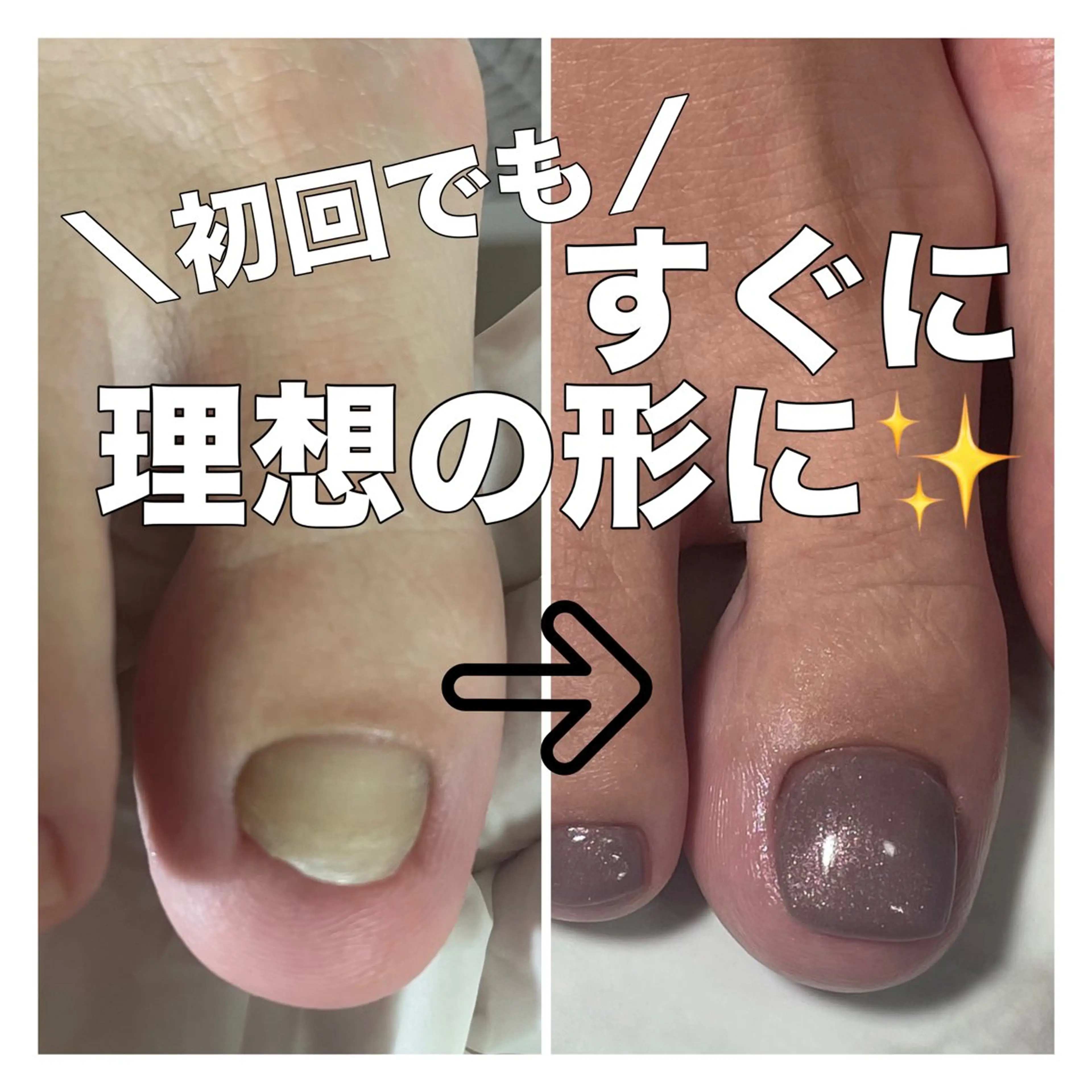 ネイル フットネイル petillant所属・nail salon petillantのネイルデザイン
