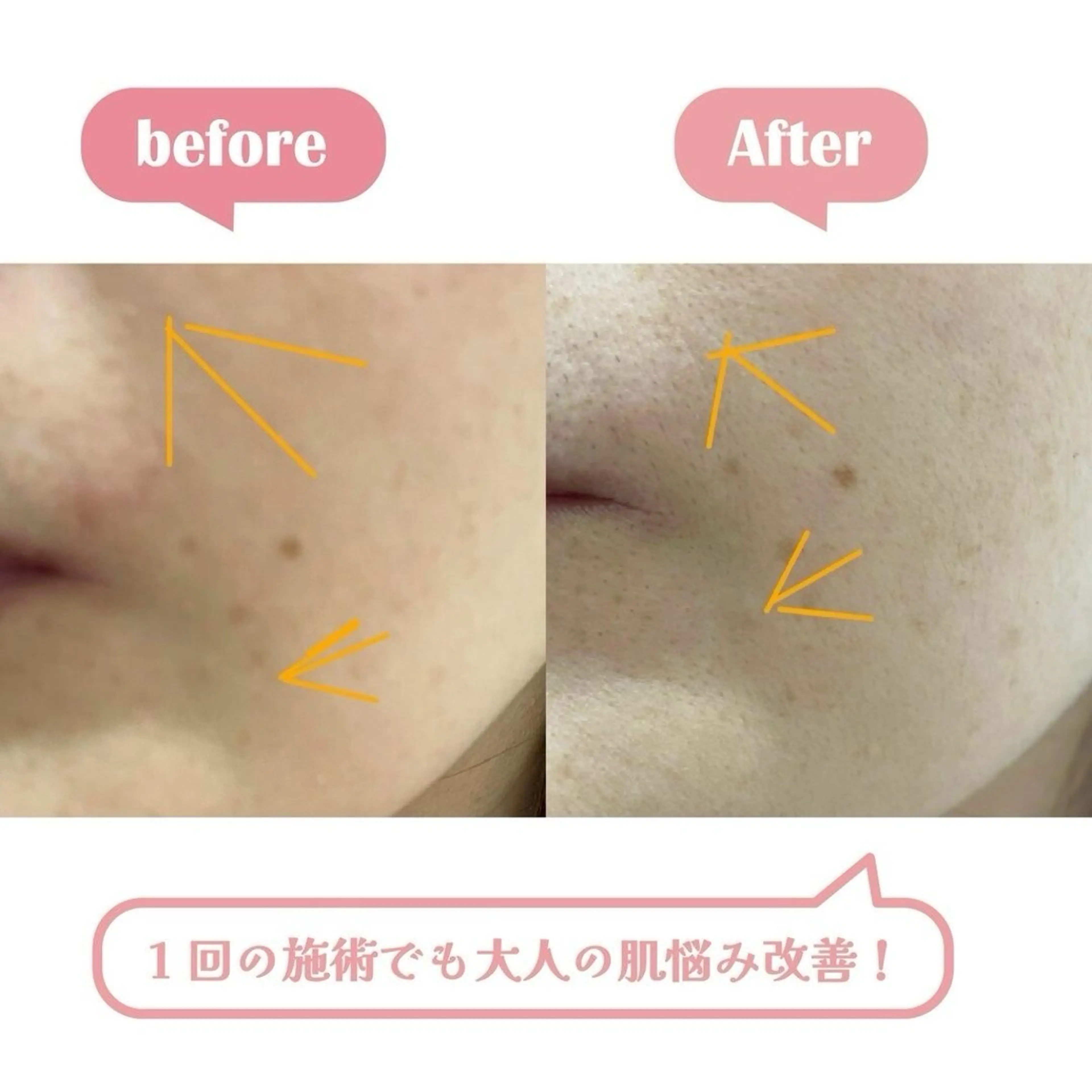 エステサロン BlooMeのエステ・リラクイメージ