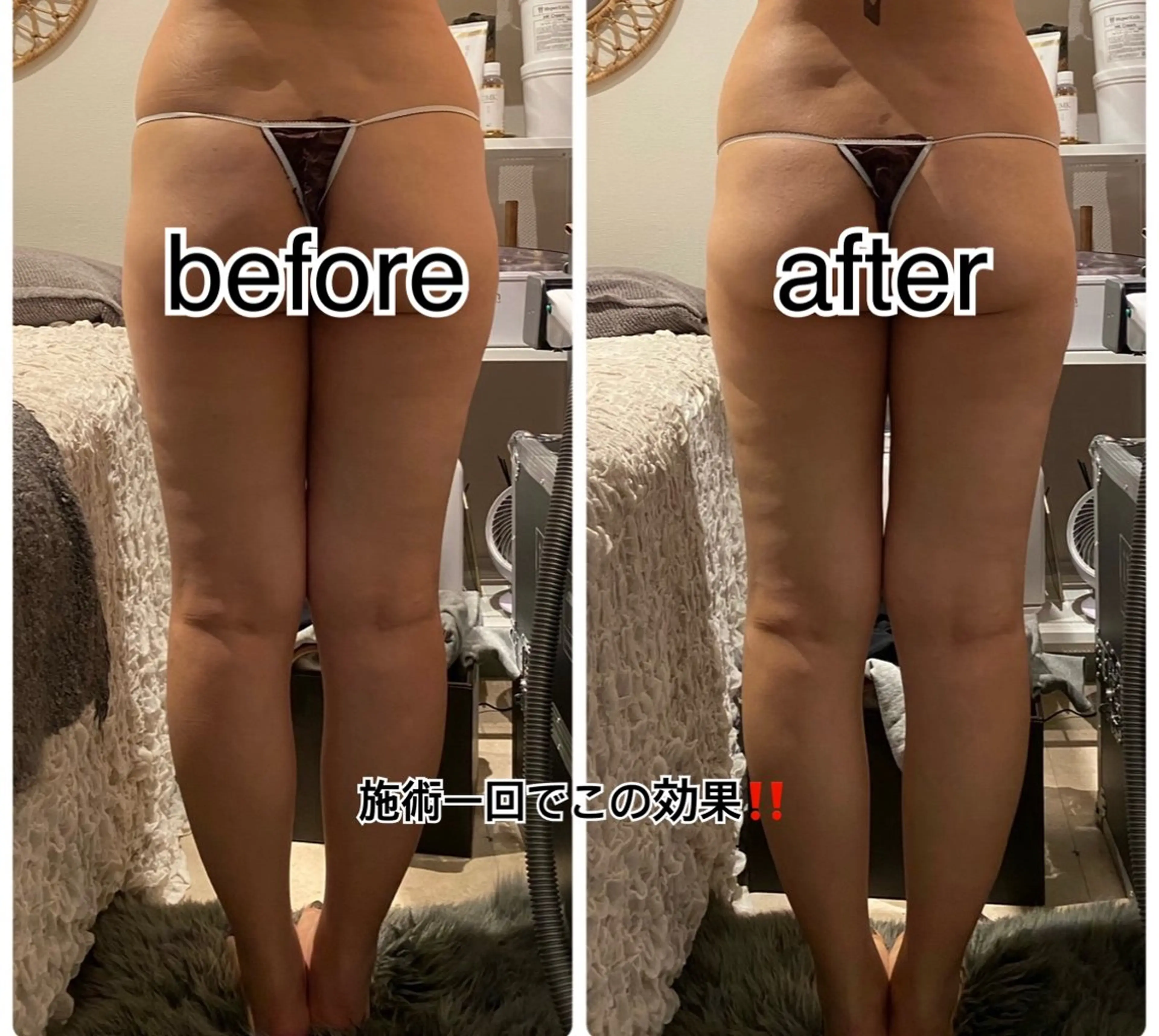 冷えむくみ改善専門 REBISKIN🌿のエステ・リラクイメージ