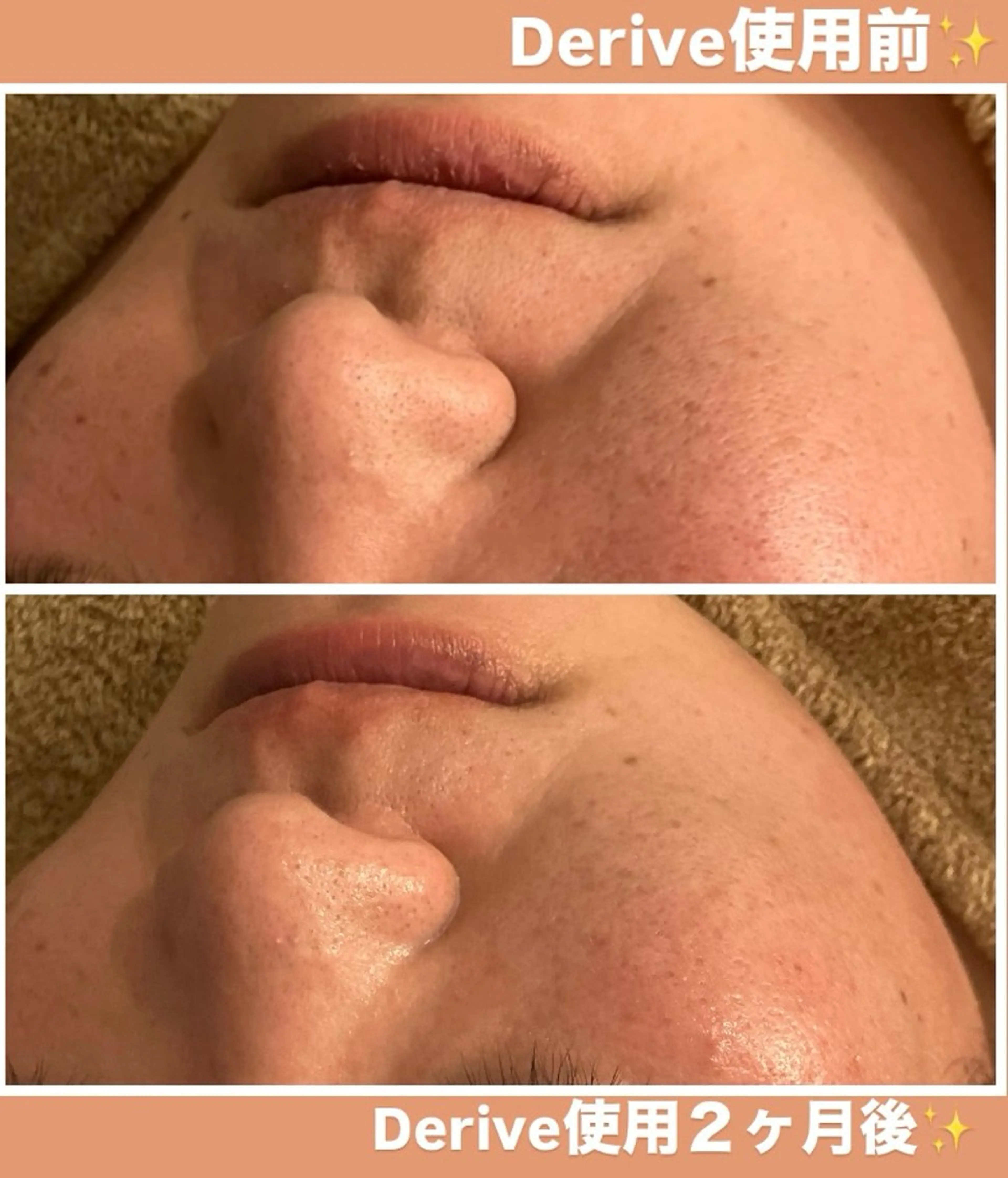 メンズ メナード岐阜茜部 杉浦のエステ・リラクイメージ