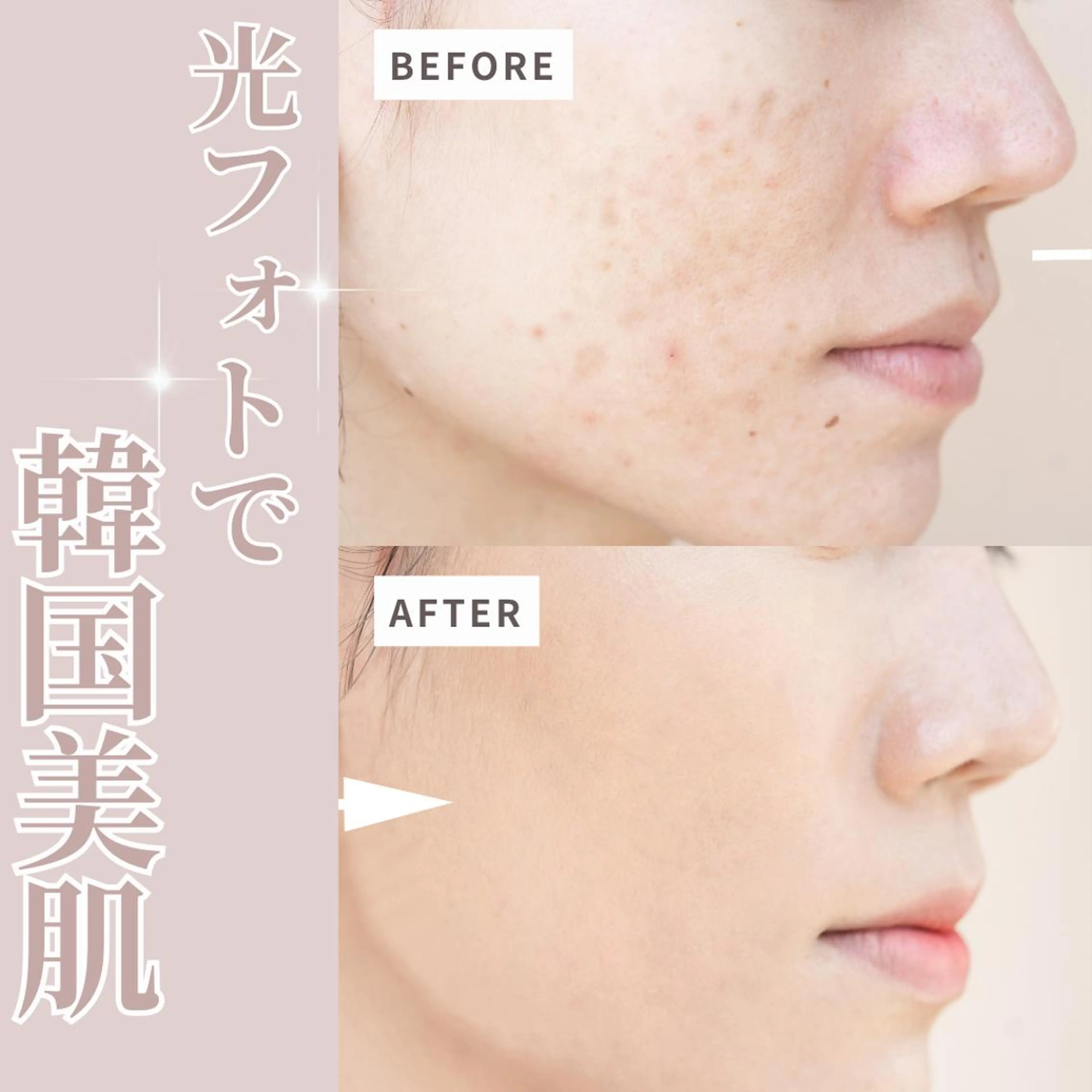 美BARI新宿店 Makiのエステ・リラクイメージ