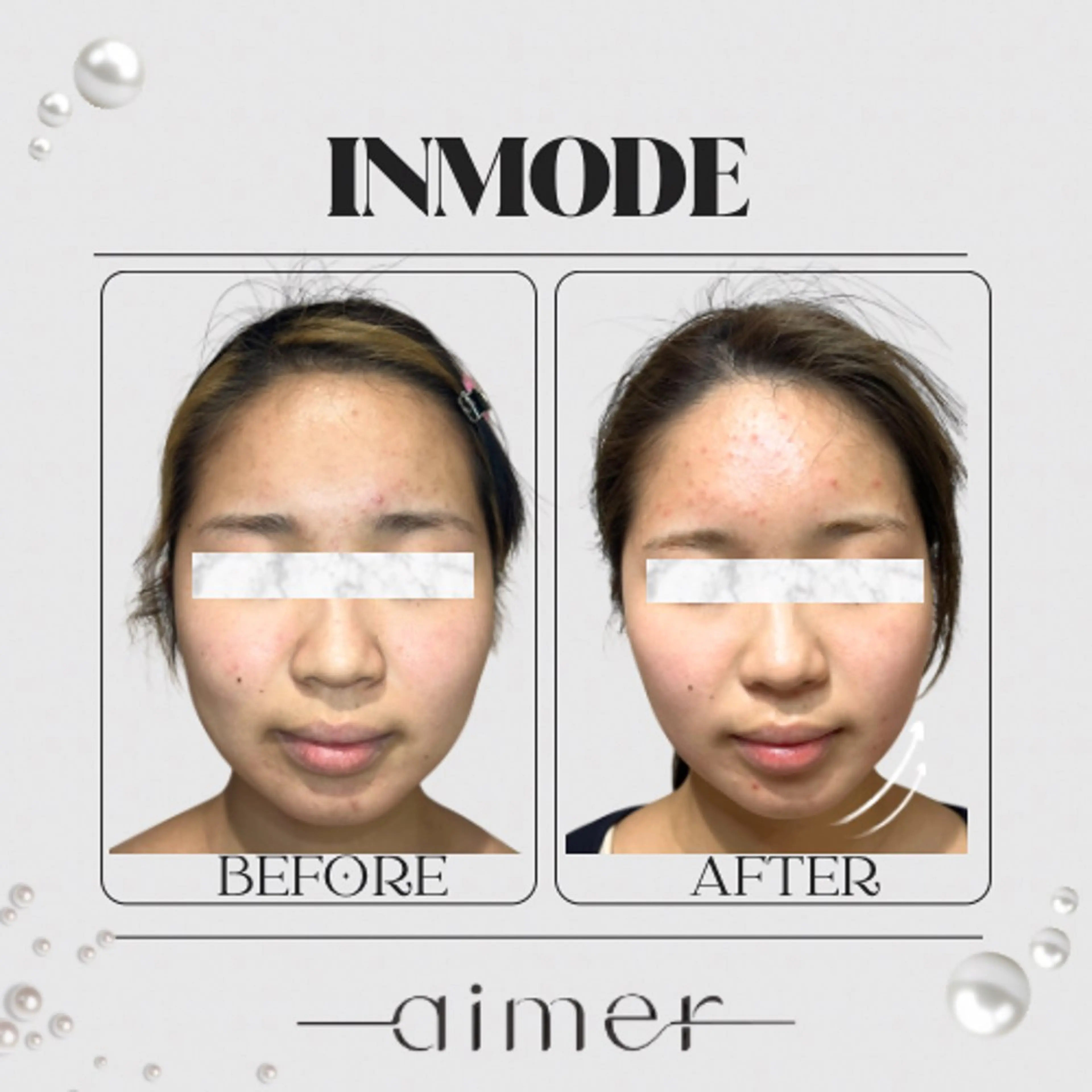 《ミニモ学割》U24❣️ インモードのみの写真