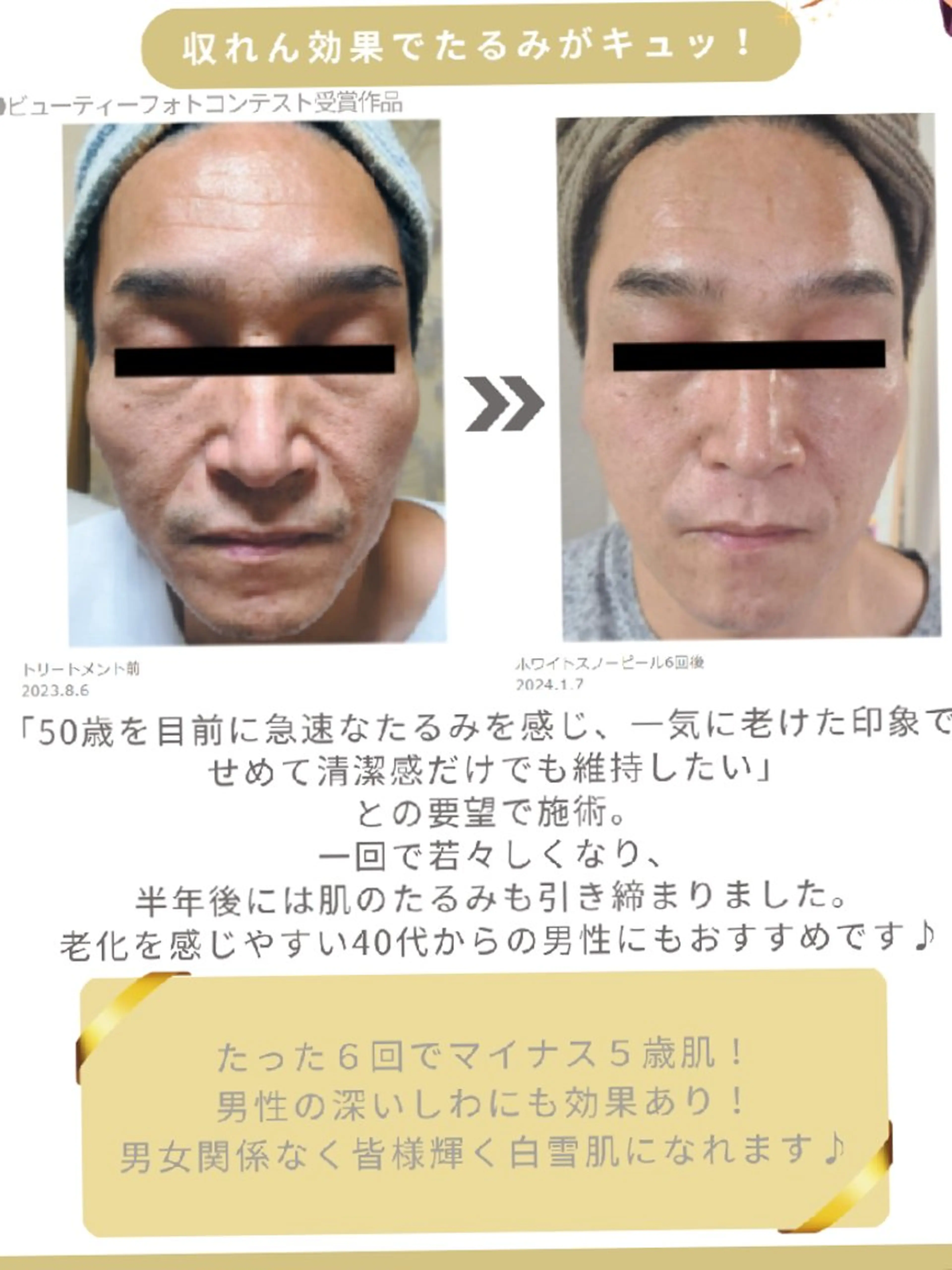 オーダーメイドフェイシャルの写真