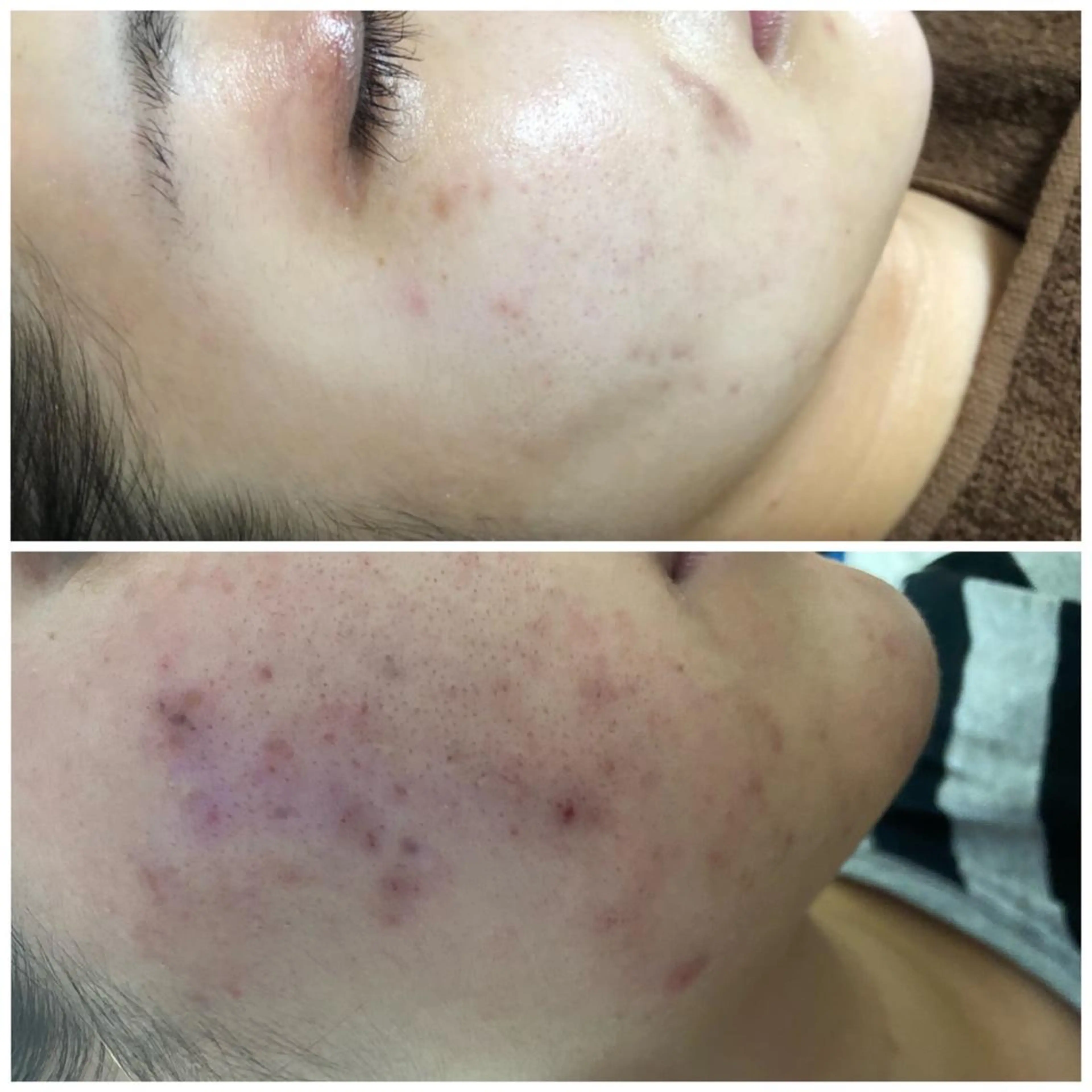 心斎橋痩身ダイエット 韓国.美容鍼.小顔のエステ・リラクイメージ