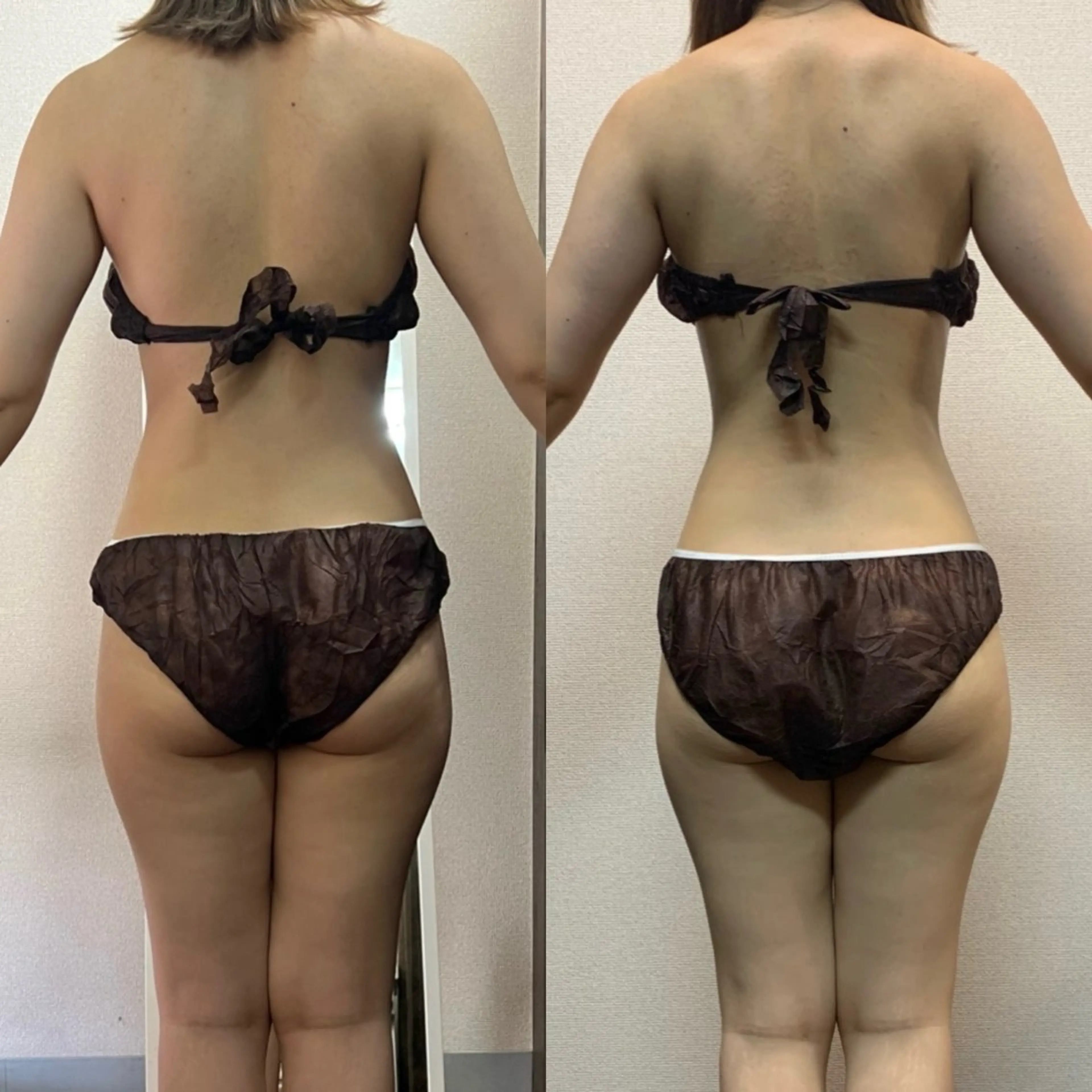 エステ ハイパーナイフ専門店　Salon de COCO所属・Salon de COCOのエステ・リラクイメージ