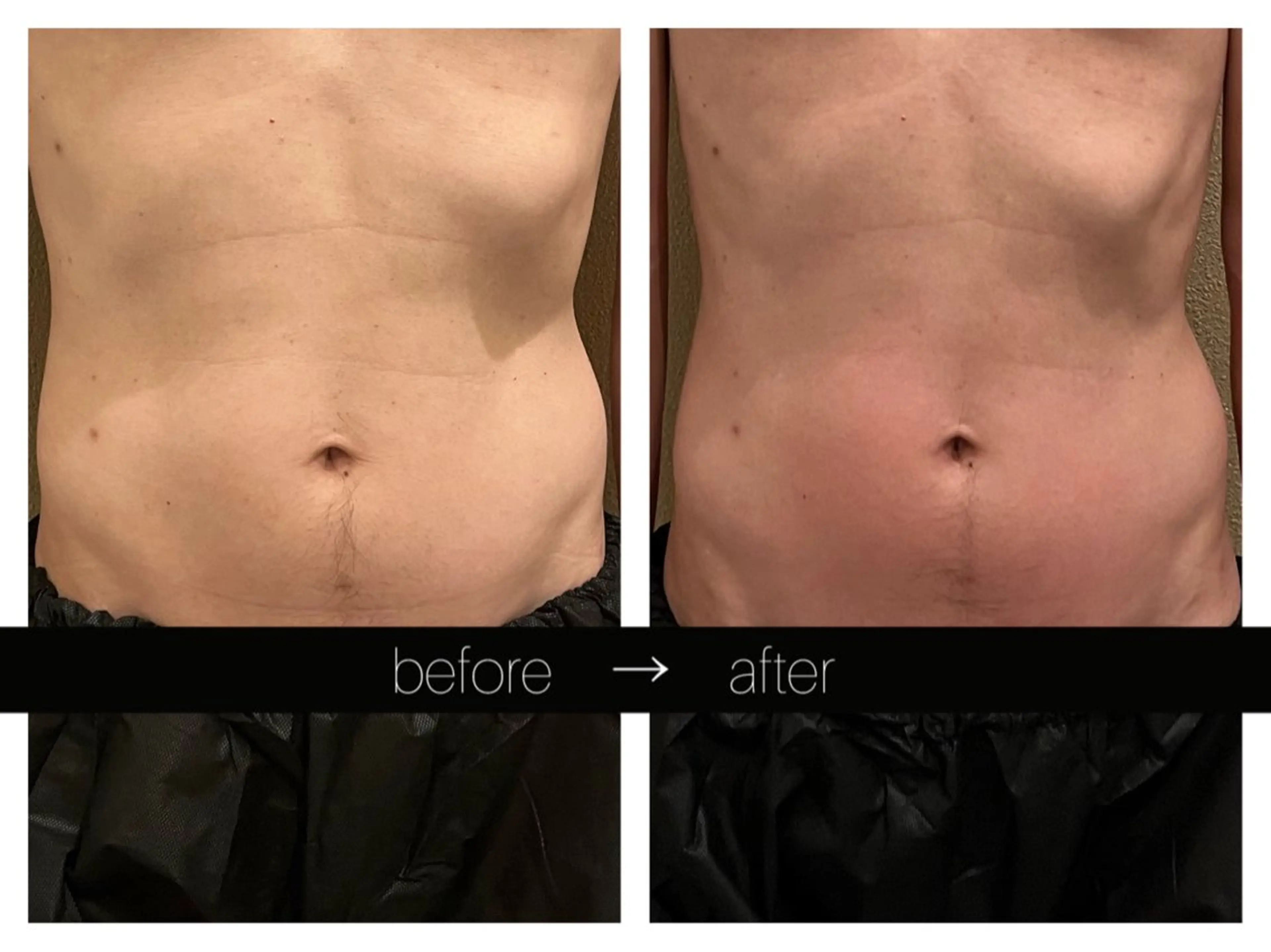 エステ リラク 小顔コルギ ☆表参道/外苑前のエステ・リラクイメージ